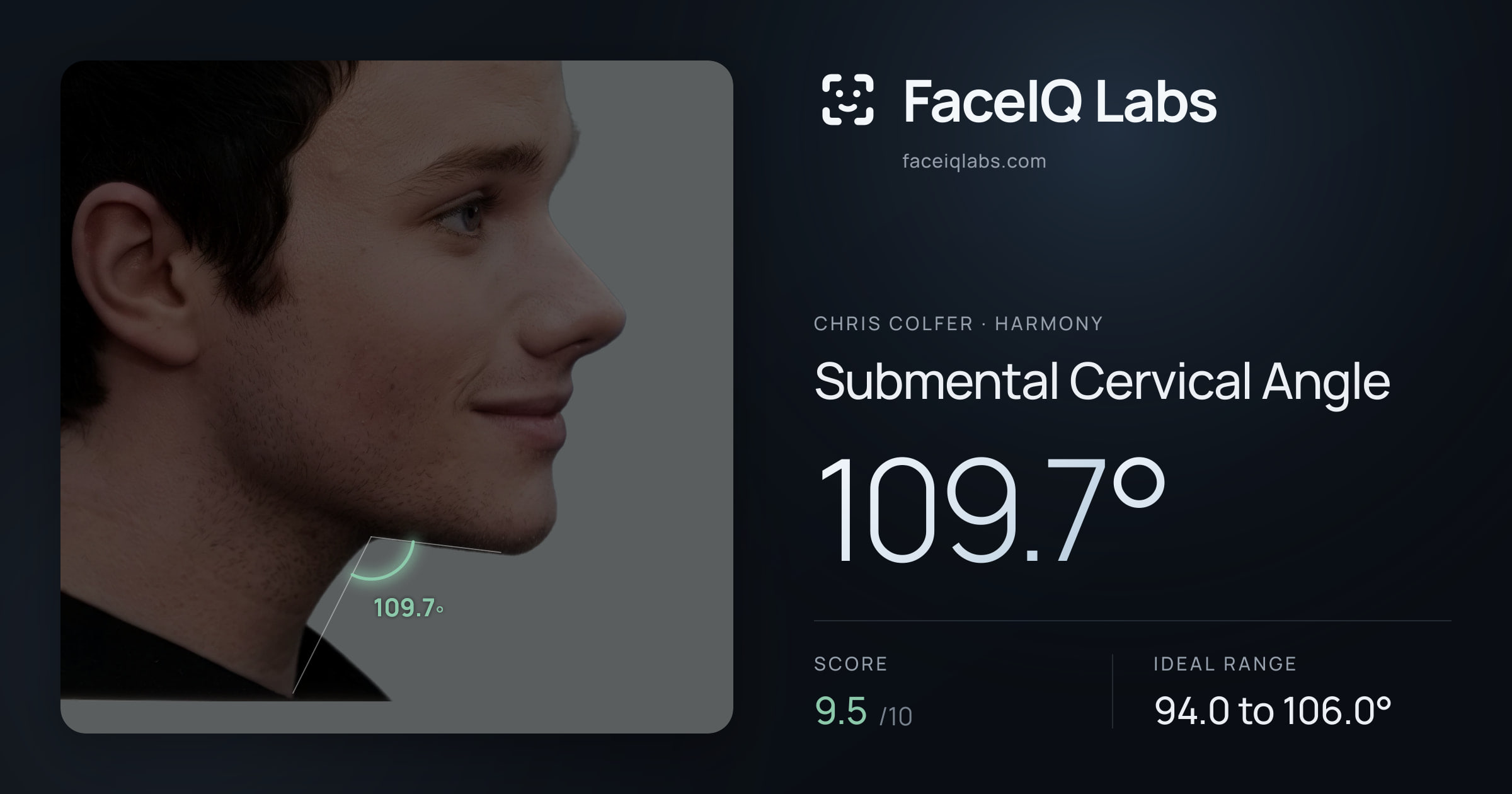 Chris Colfer Submental Cervical Angle: 109.7°, drawn on the photo