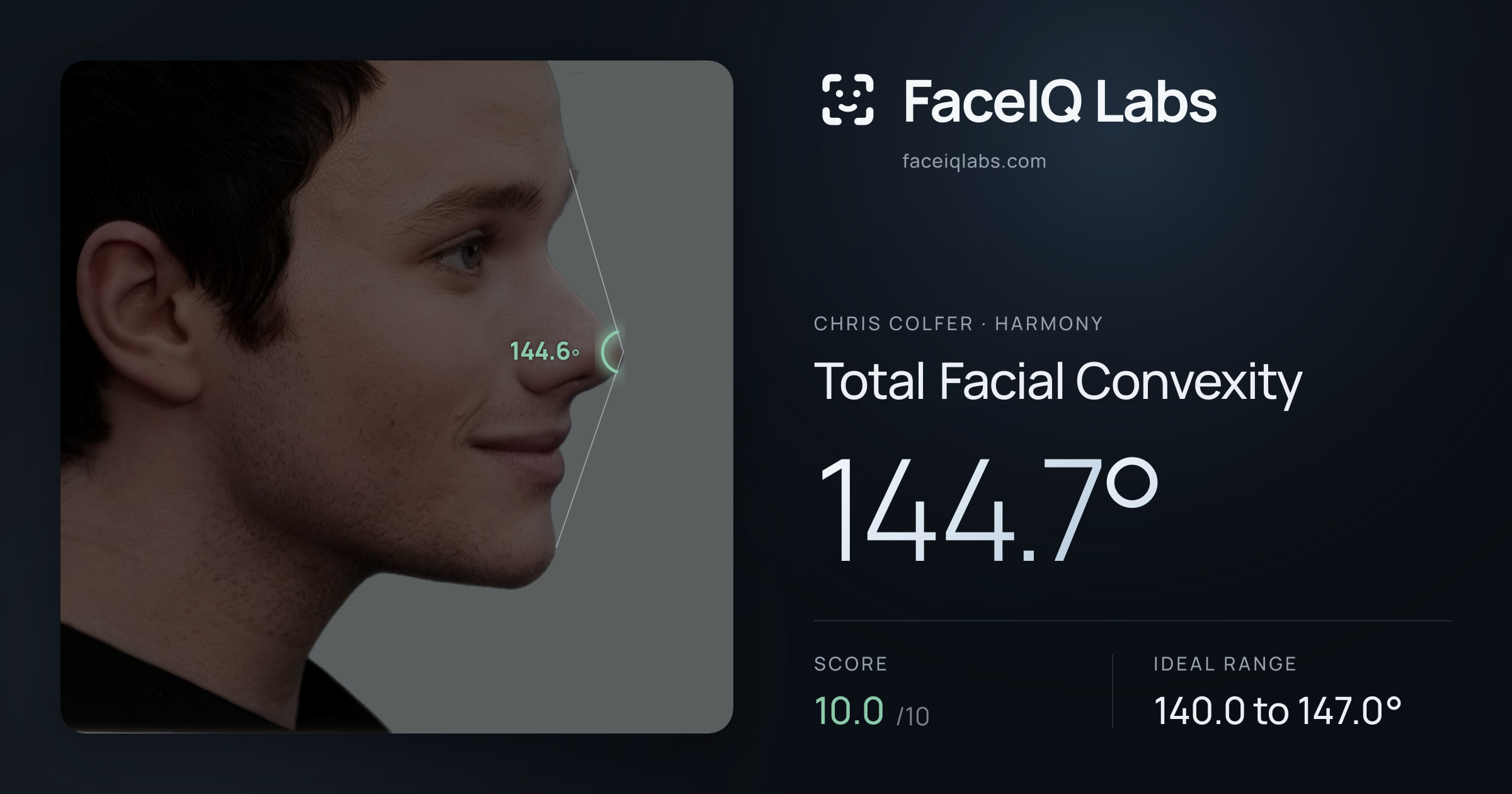 Chris Colfer Total Facial Convexity: 144.7°, drawn on the photo