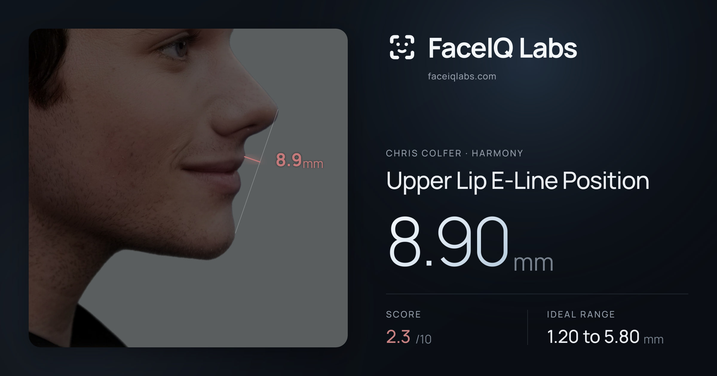Chris Colfer Upper Lip E-Line Position: 8.90mm, drawn on the photo