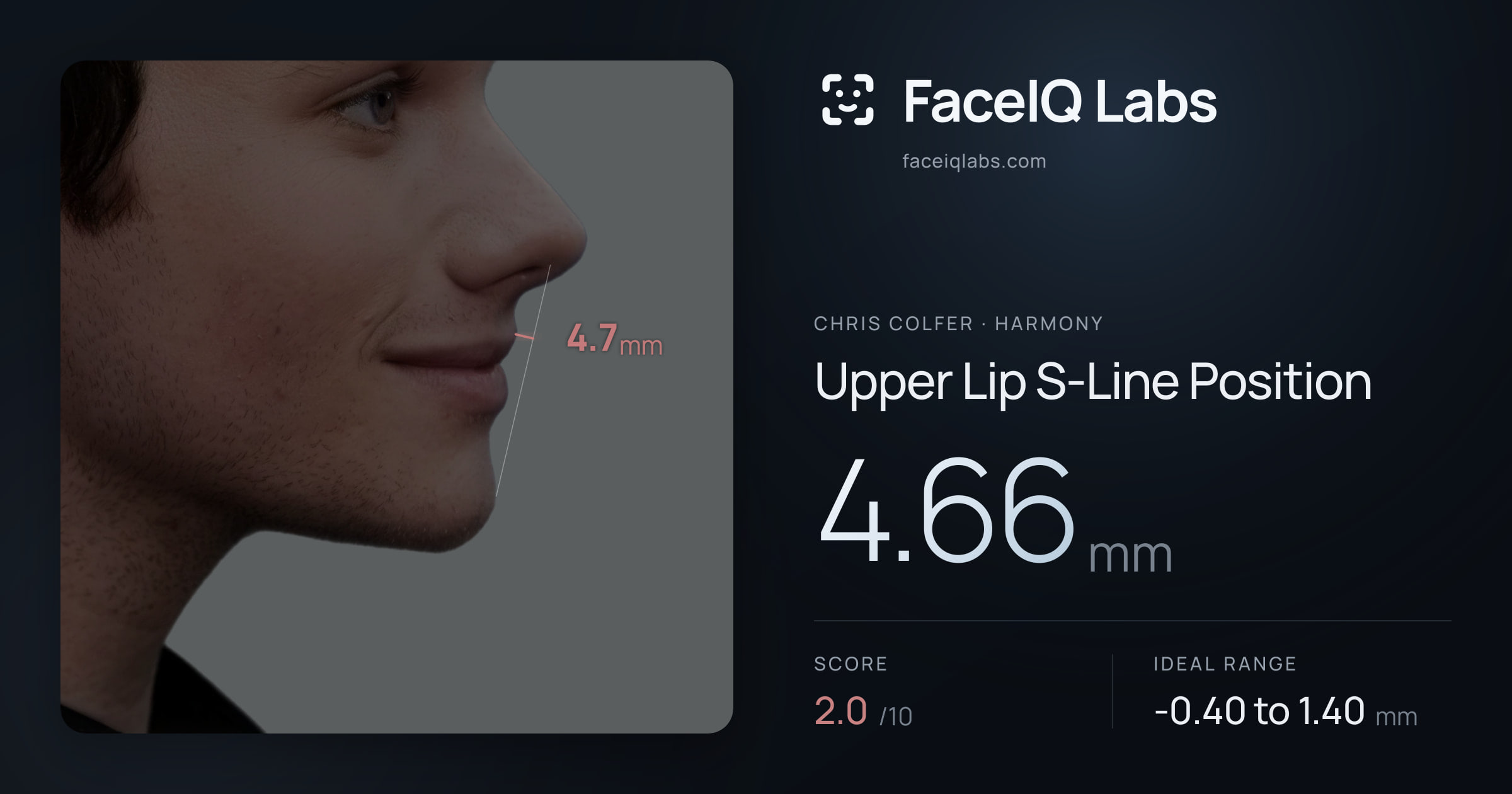 Chris Colfer Upper Lip S-Line Position: 4.66mm, drawn on the photo