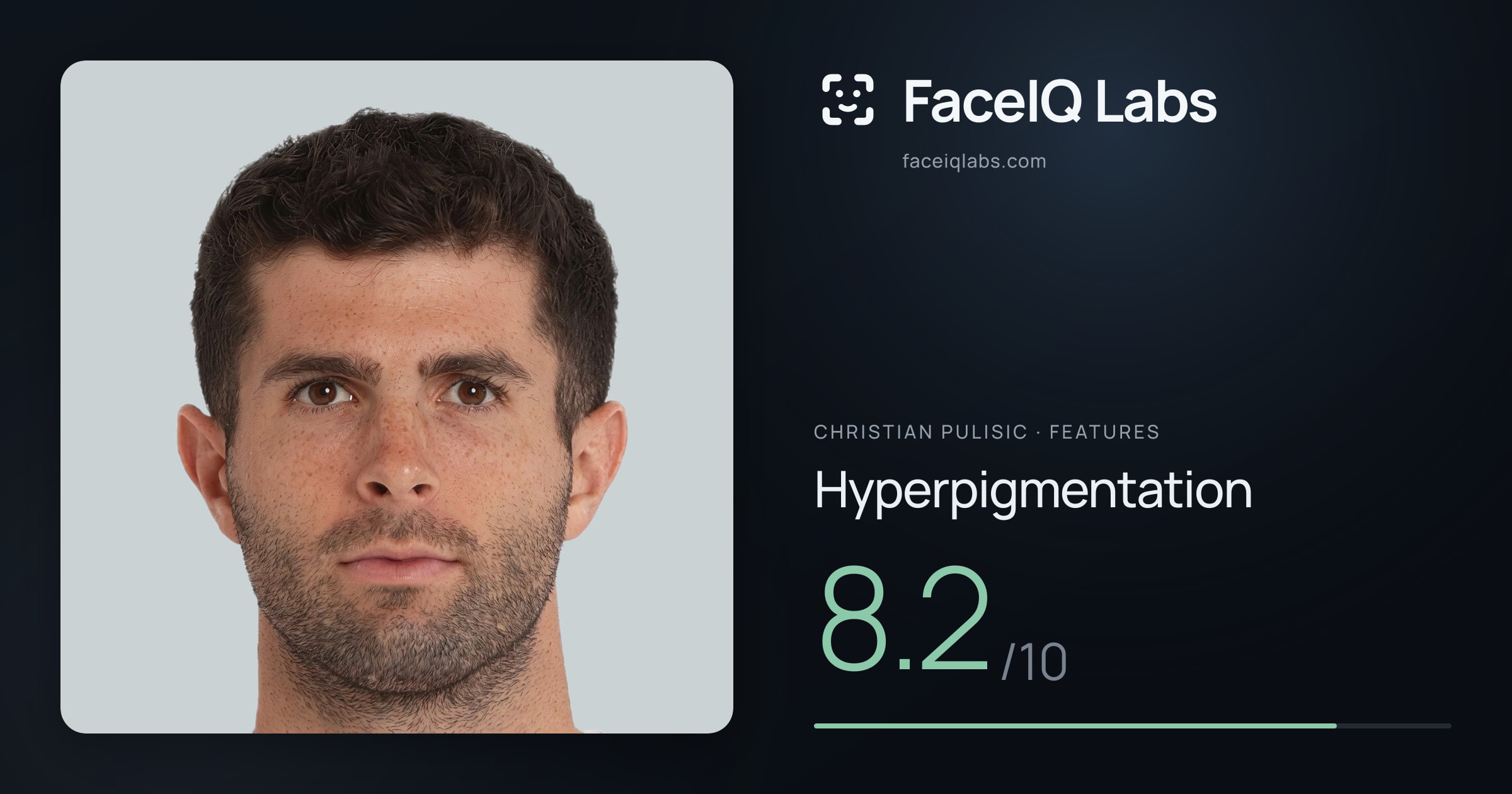 Christian Pulisic Hyperpigmentation: 8.2/10, drawn on the photo