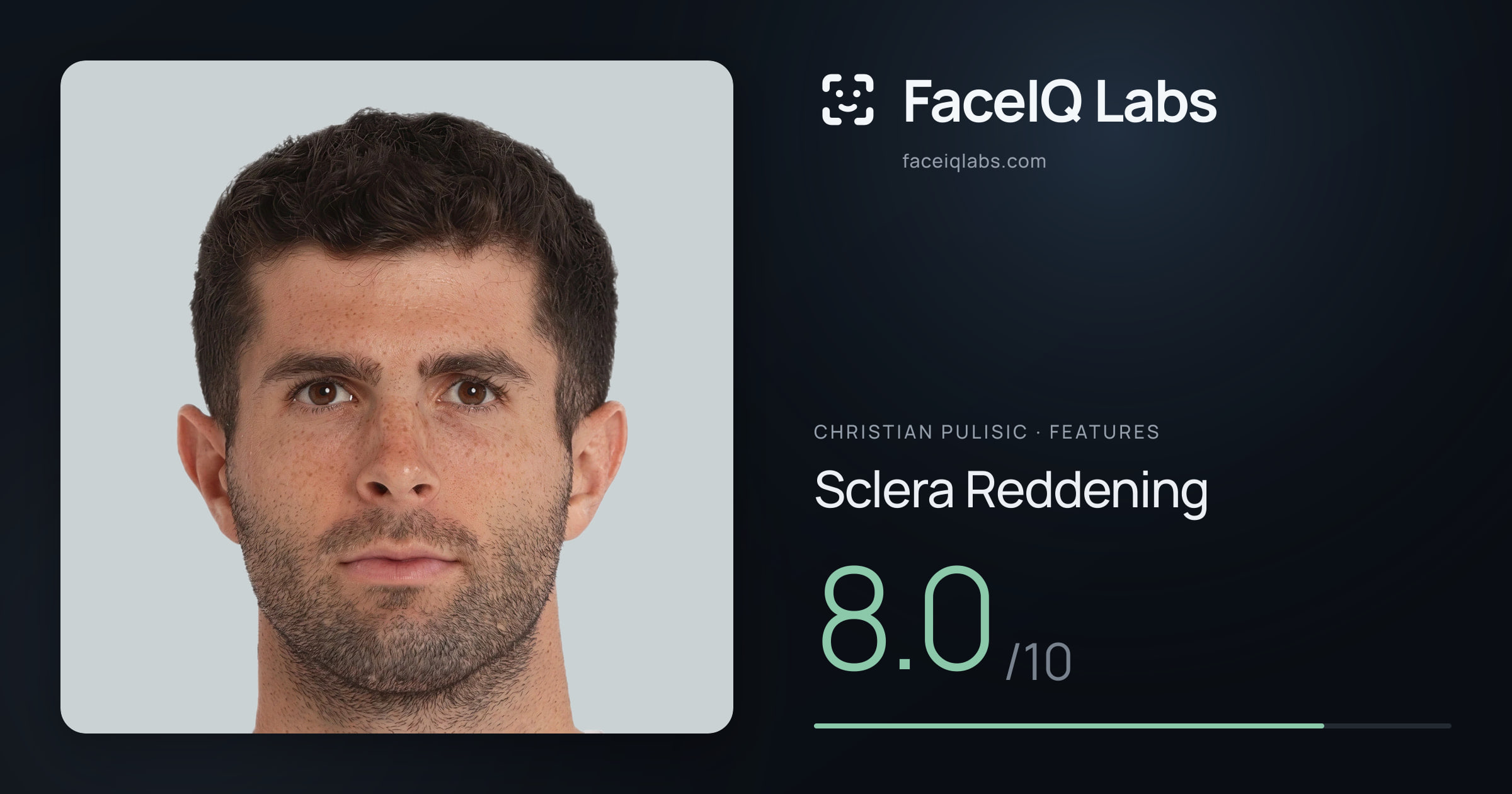 Christian Pulisic Sclera Reddening: 8.0/10, drawn on the photo