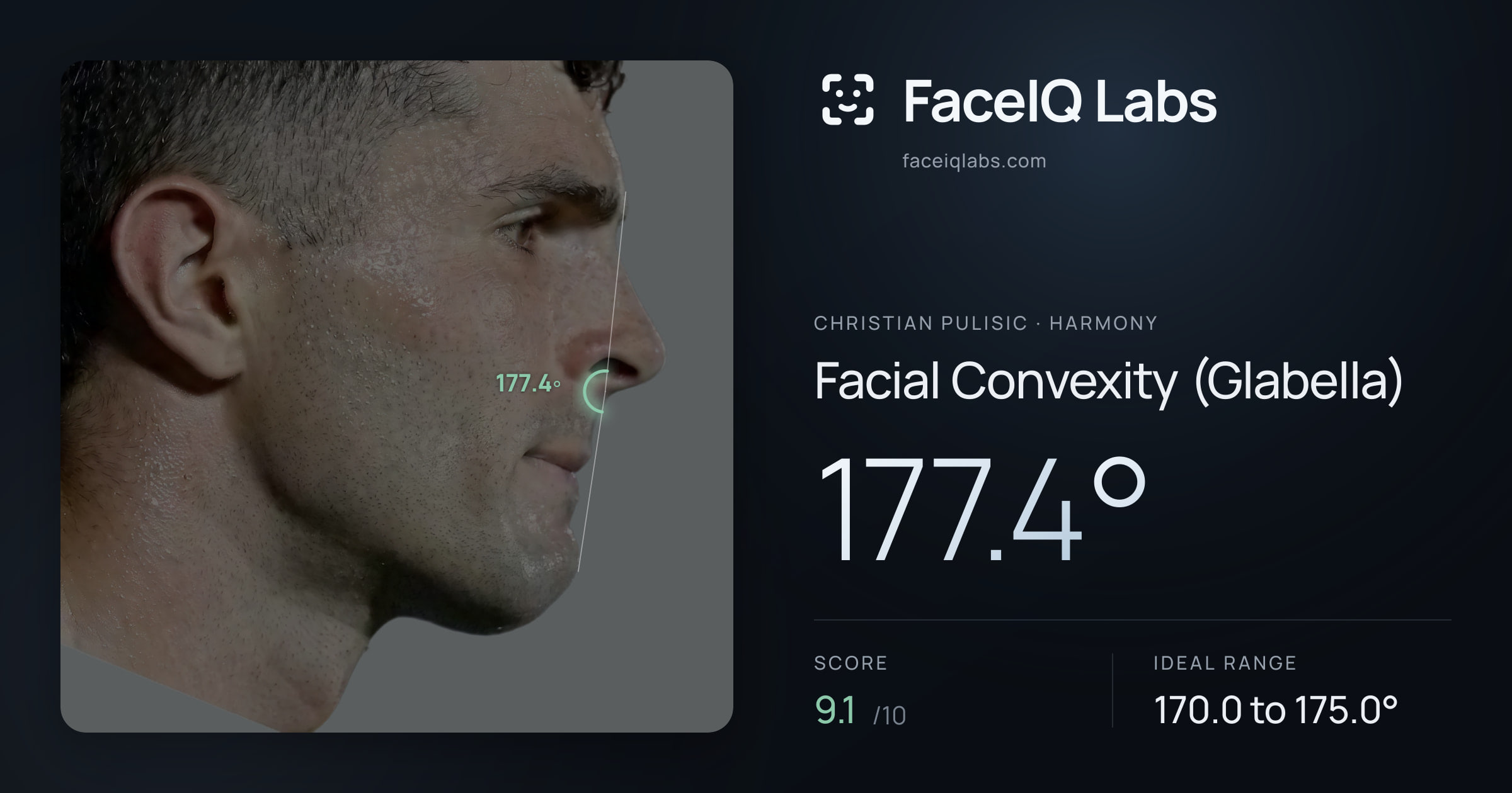 Christian Pulisic Facial Convexity (Glabella): 177.4°, drawn on the photo
