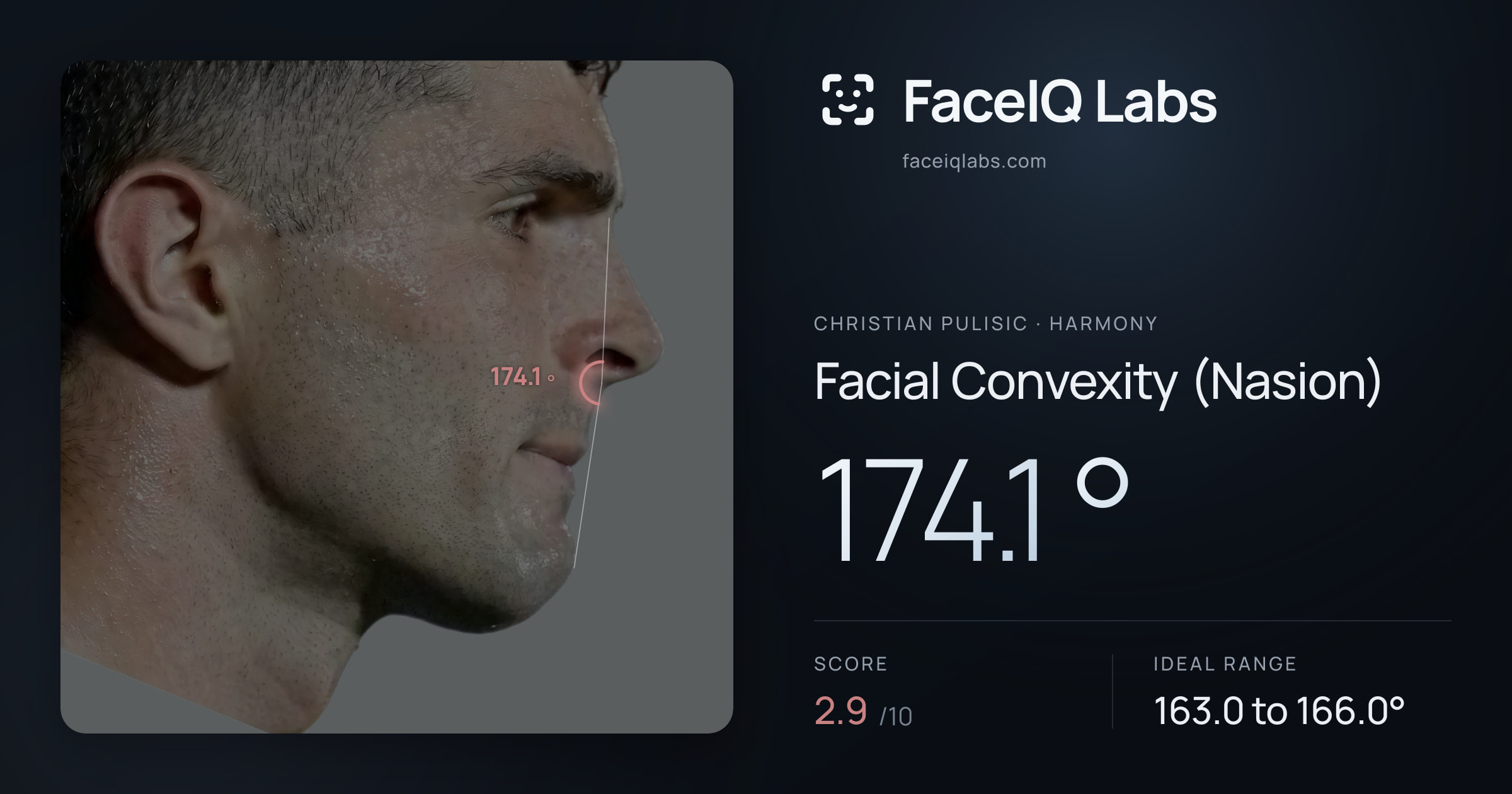 Christian Pulisic Facial Convexity (Nasion): 174.1°, drawn on the photo