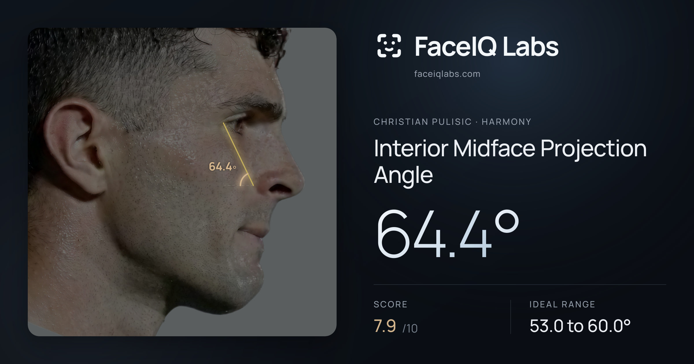 Christian Pulisic Interior Midface Projection Angle: 64.4°, drawn on the photo