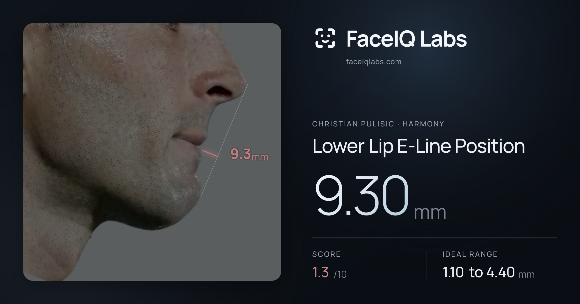 Christian Pulisic Lower Lip E-Line Position: 9.30mm, drawn on the photo