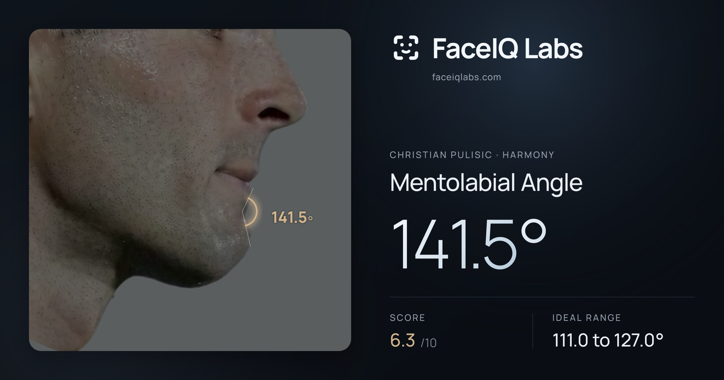 Christian Pulisic Mentolabial Angle: 141.5°, drawn on the photo