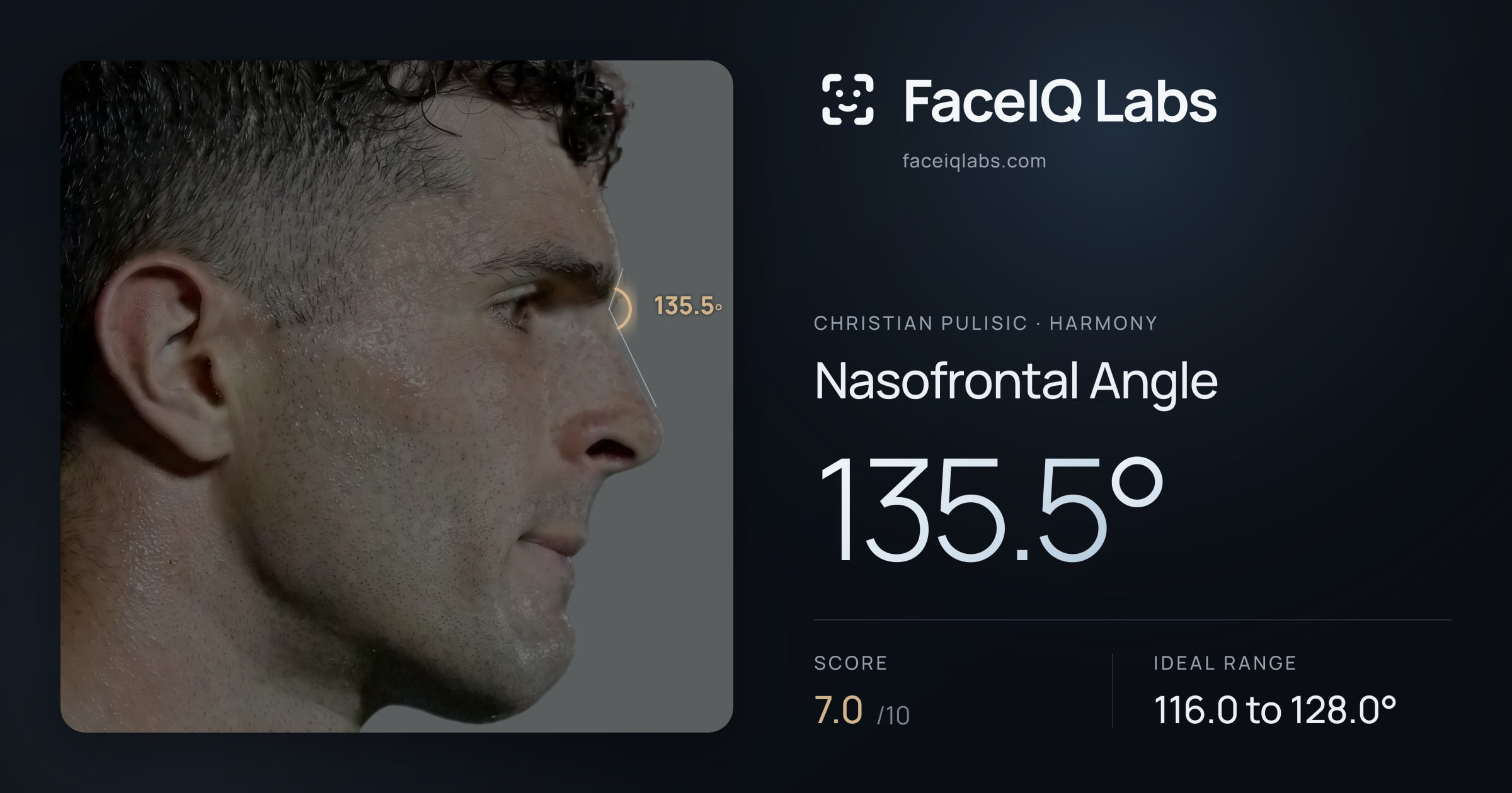 Christian Pulisic Nasofrontal Angle: 135.5°, drawn on the photo