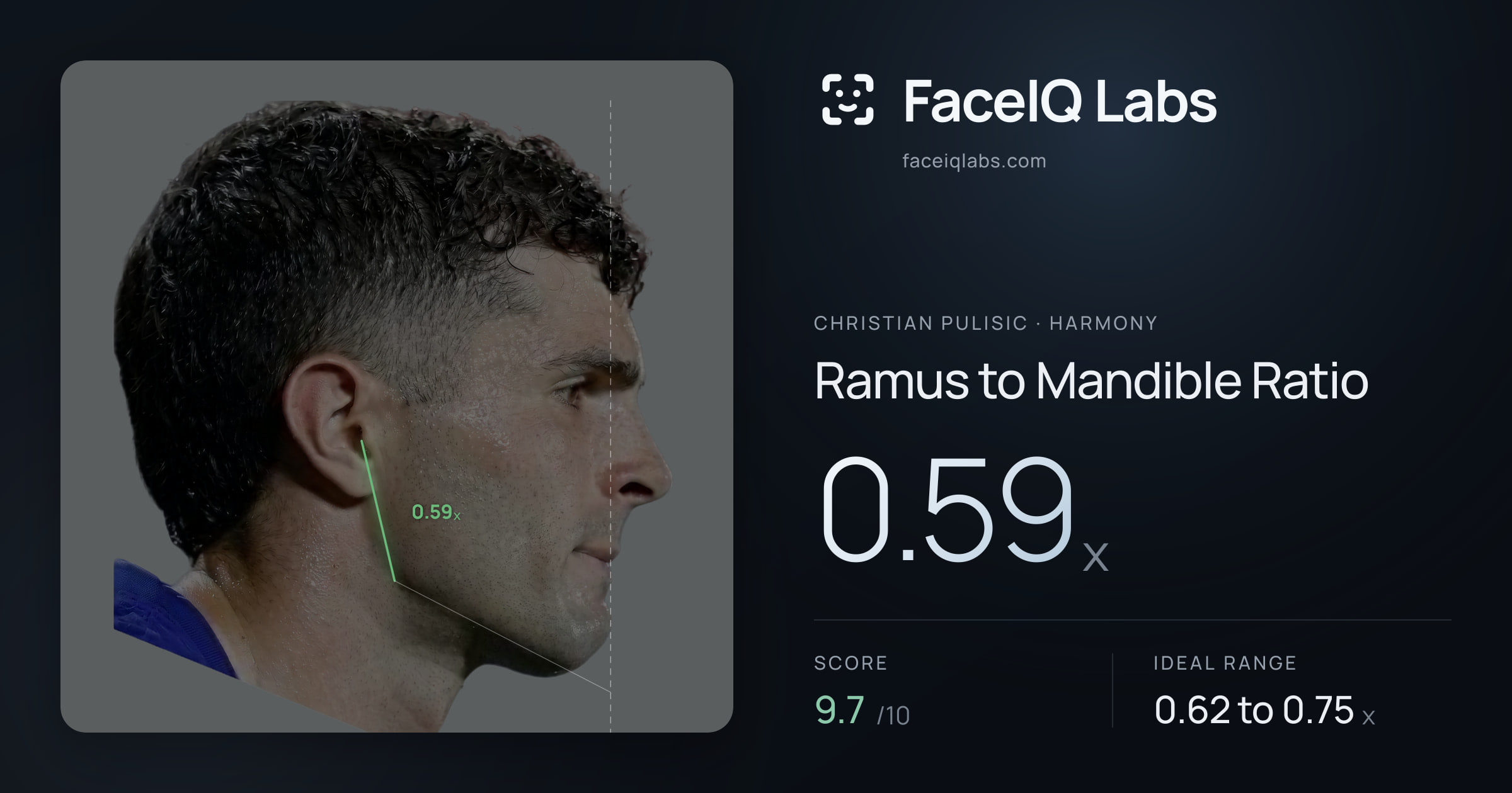 Christian Pulisic Ramus to Mandible Ratio: 0.59x, drawn on the photo