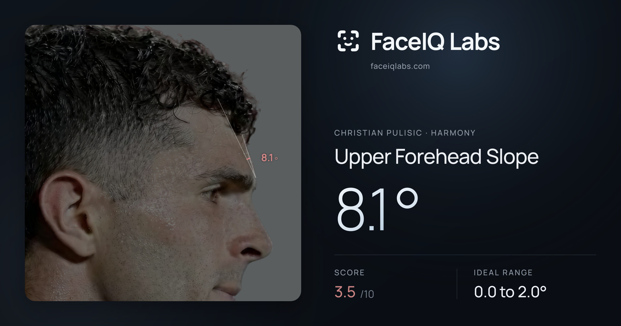 Christian Pulisic Upper Forehead Slope: 8.1°, drawn on the photo
