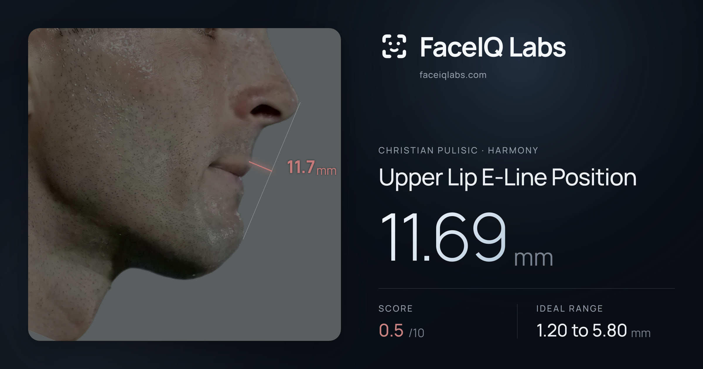 Christian Pulisic Upper Lip E-Line Position: 11.69mm, drawn on the photo
