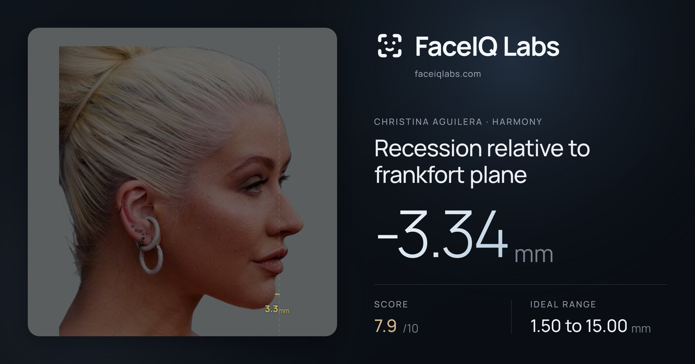 Christina Aguilera Recession relative to frankfort plane: -3.34mm, drawn on the photo