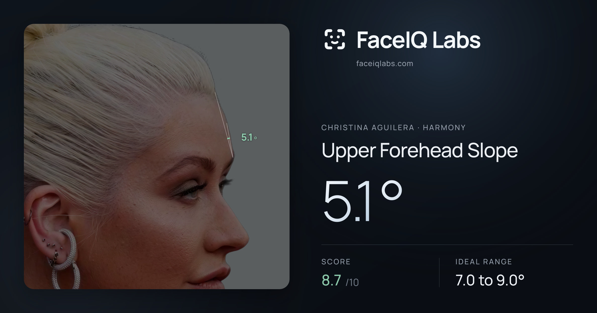 Christina Aguilera Upper Forehead Slope: 5.1°, drawn on the photo