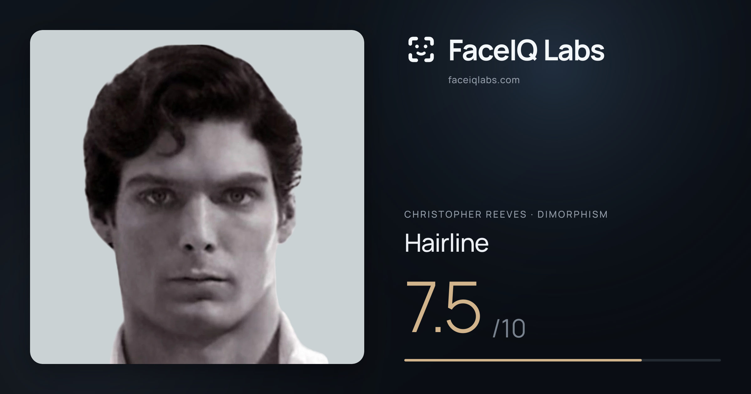 Christopher Reeves Hairline: 7.5/10, drawn on the photo