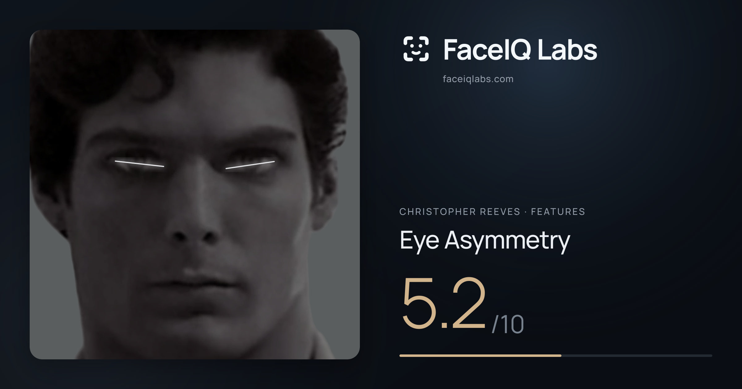 Christopher Reeves Eye Asymmetry: 5.2/10, drawn on the photo