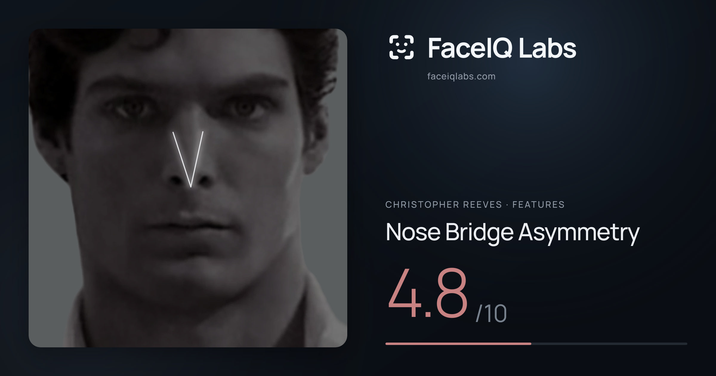 Christopher Reeves Nose Bridge Asymmetry: 4.8/10, drawn on the photo