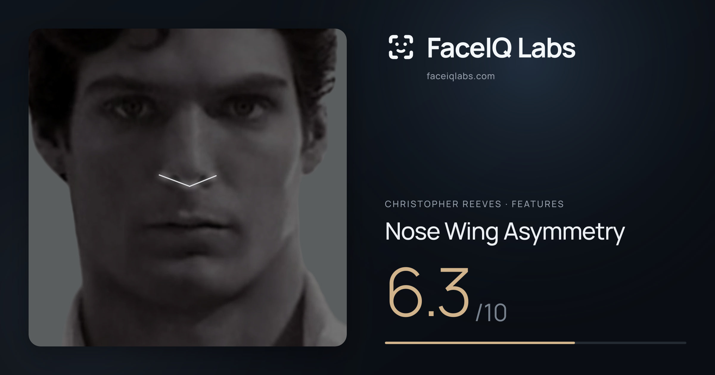 Christopher Reeves Nose Wing Asymmetry: 6.3/10, drawn on the photo
