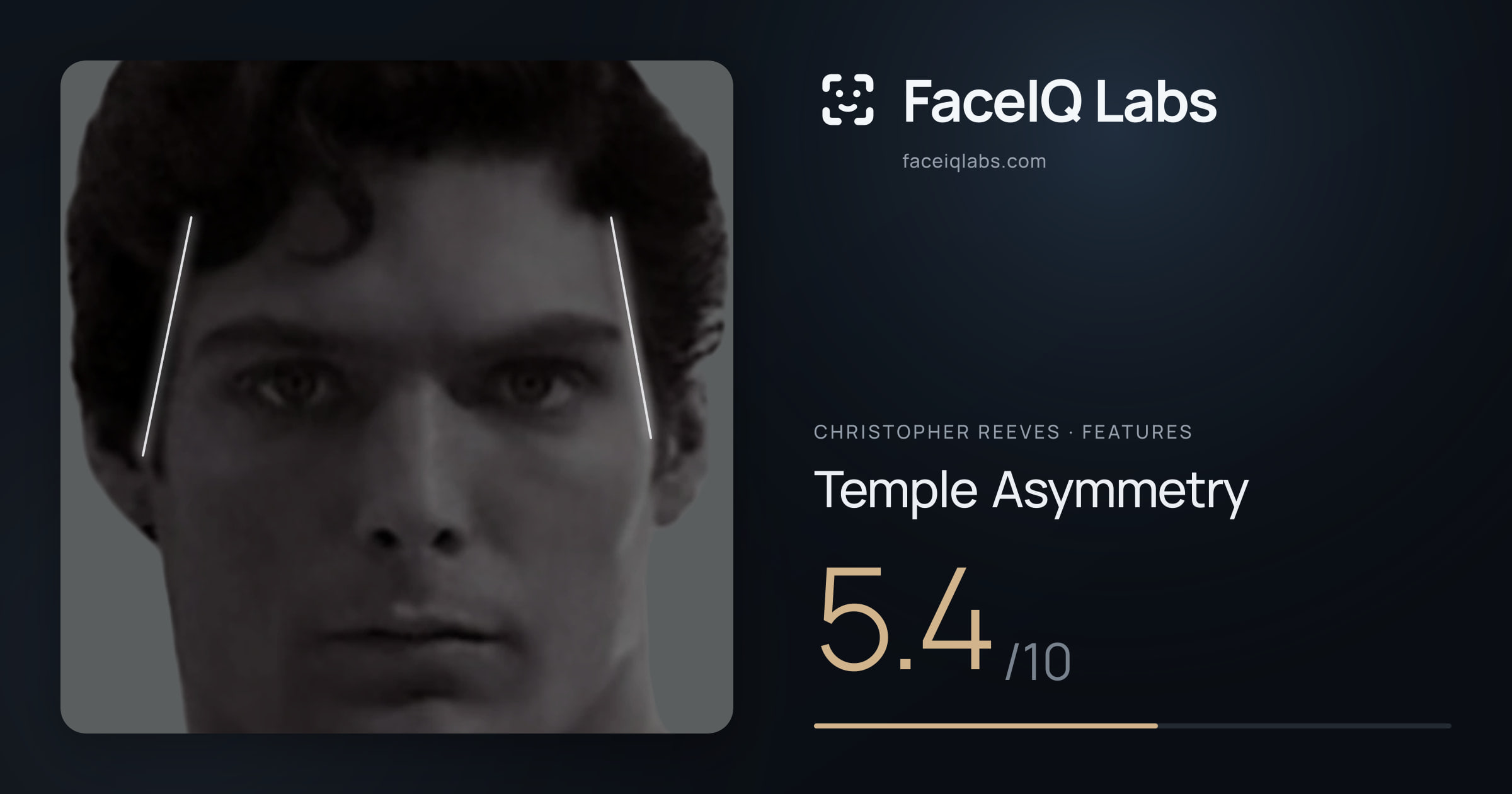 Christopher Reeves Temple Asymmetry: 5.4/10, drawn on the photo
