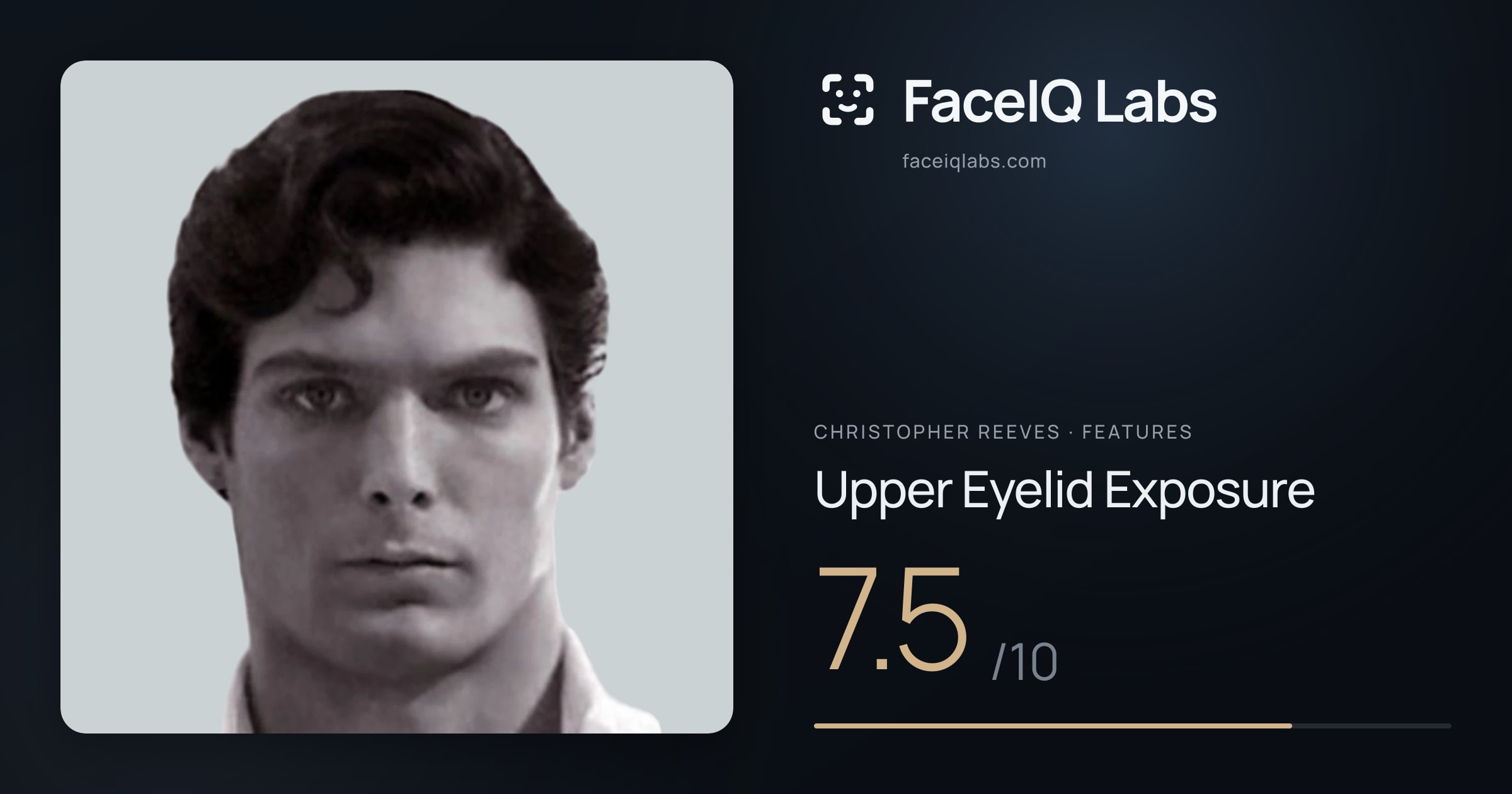 Christopher Reeves Upper Eyelid Exposure: 7.5/10, drawn on the photo