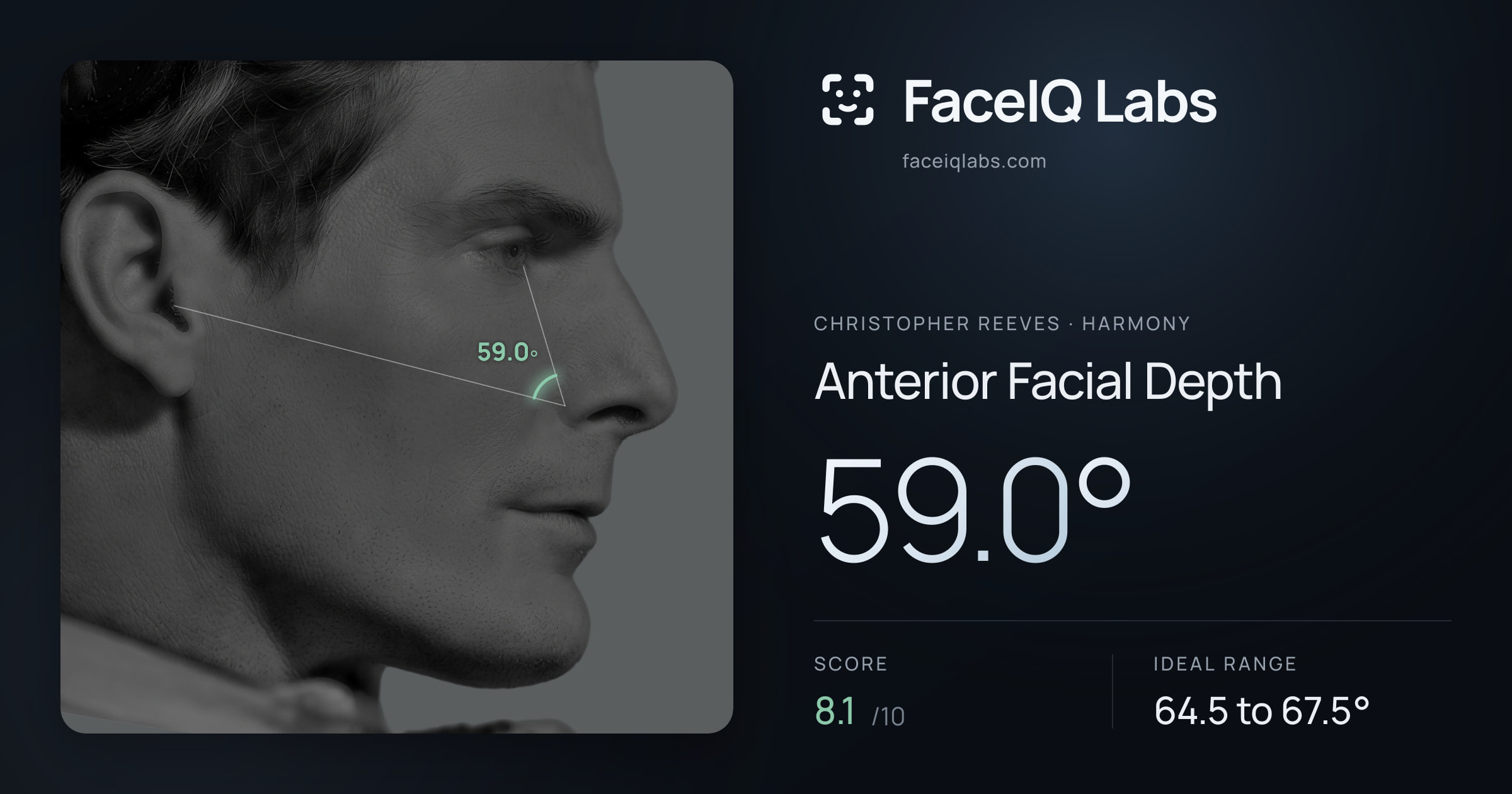 Christopher Reeves Anterior Facial Depth: 59.0°, drawn on the photo