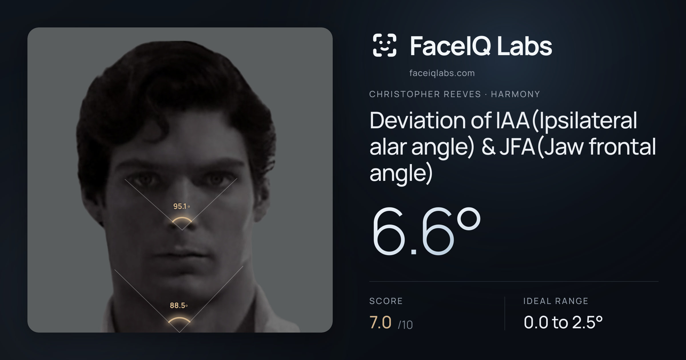 Christopher Reeves Deviation of IAA(Ipsilateral alar angle) & JFA(Jaw frontal angle): 6.6°, drawn on the photo