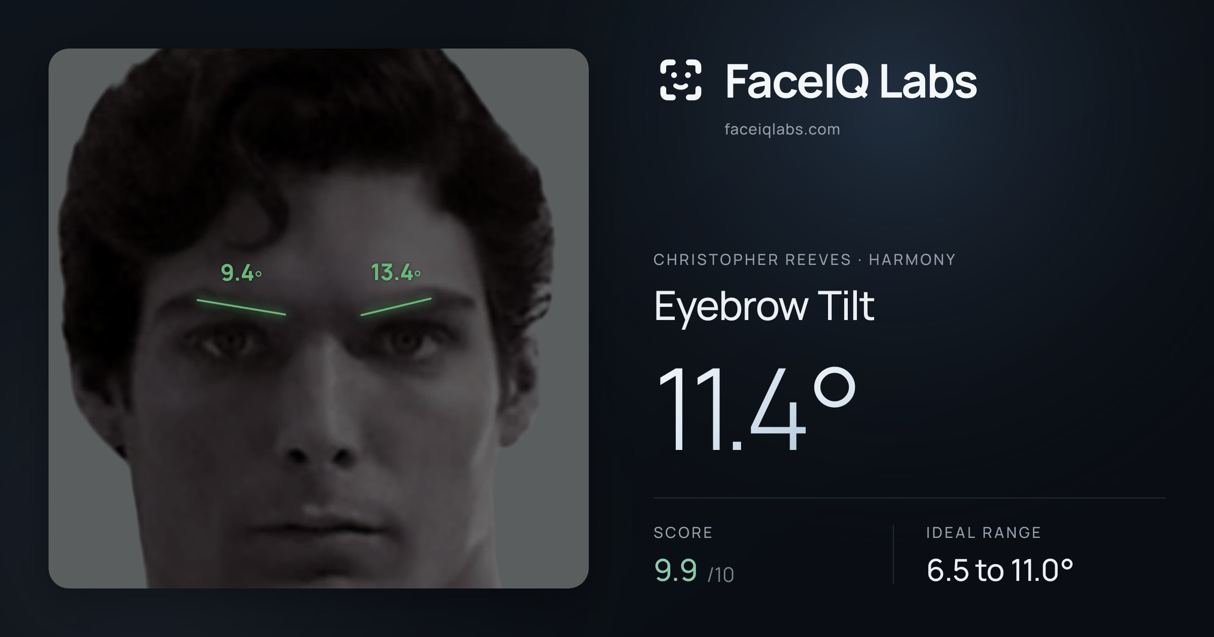 Christopher Reeves Eyebrow Tilt: 11.4°, drawn on the photo