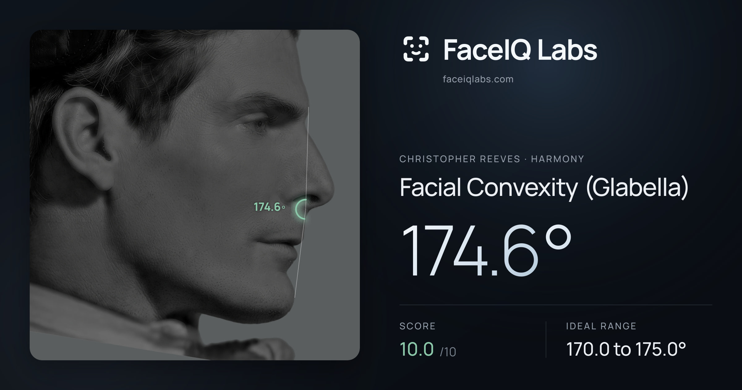 Christopher Reeves Facial Convexity (Glabella): 174.6°, drawn on the photo