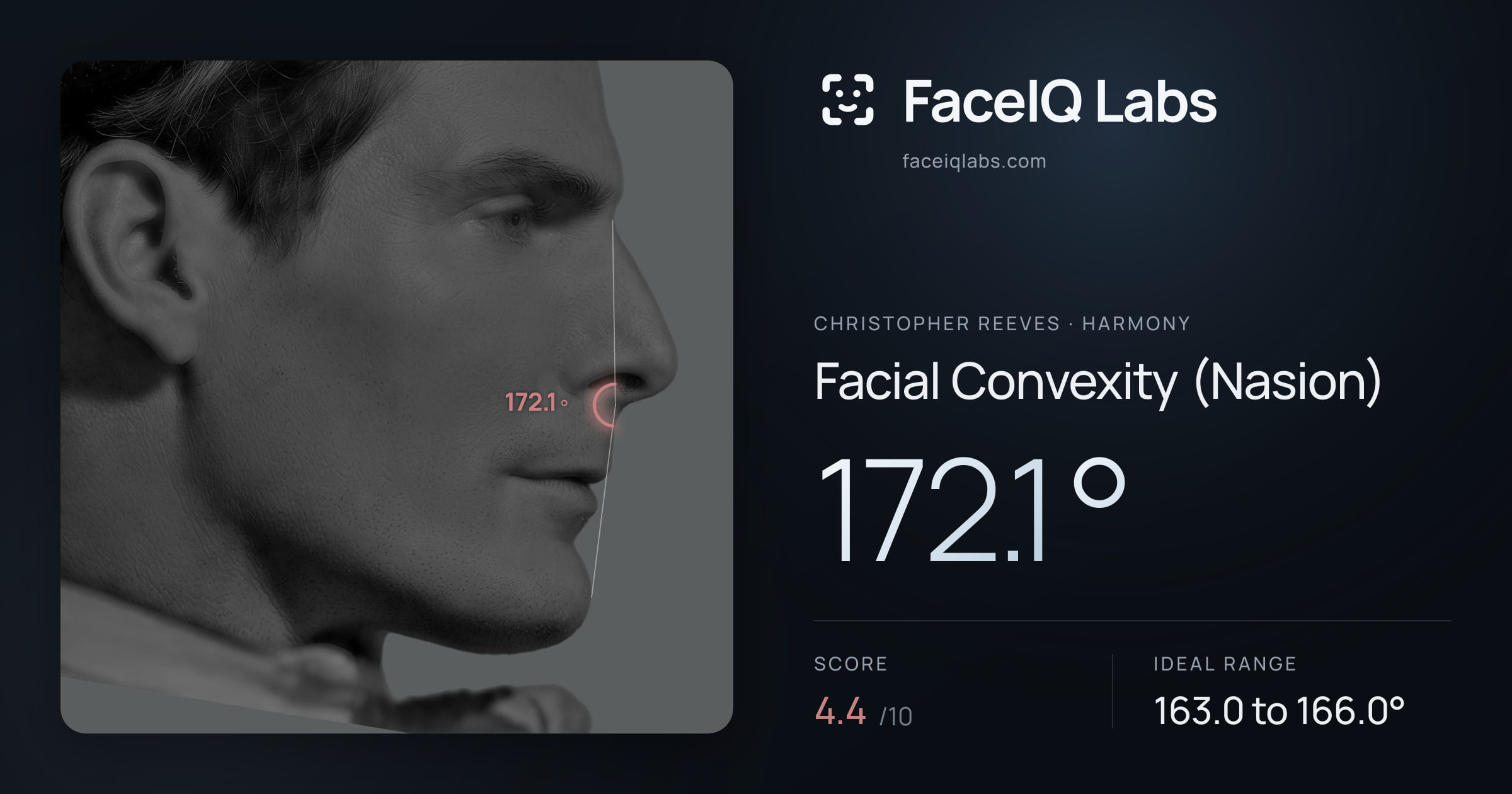 Christopher Reeves Facial Convexity (Nasion): 172.1°, drawn on the photo