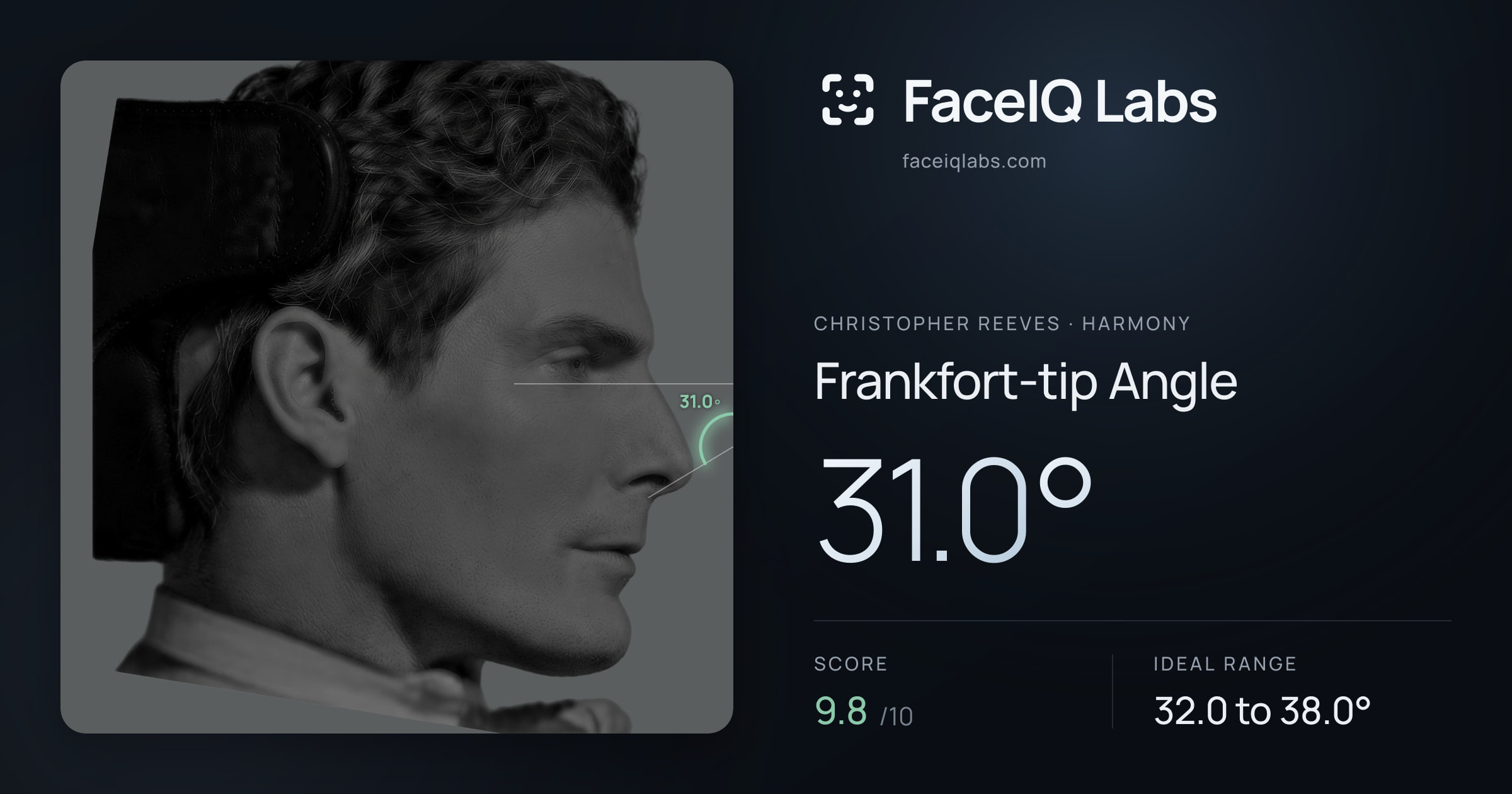 Christopher Reeves Frankfort-tip Angle: 31.0°, drawn on the photo