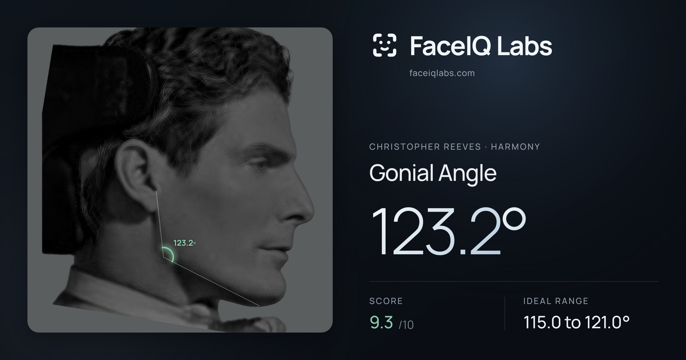 Christopher Reeves Gonial Angle: 123.2°, drawn on the photo