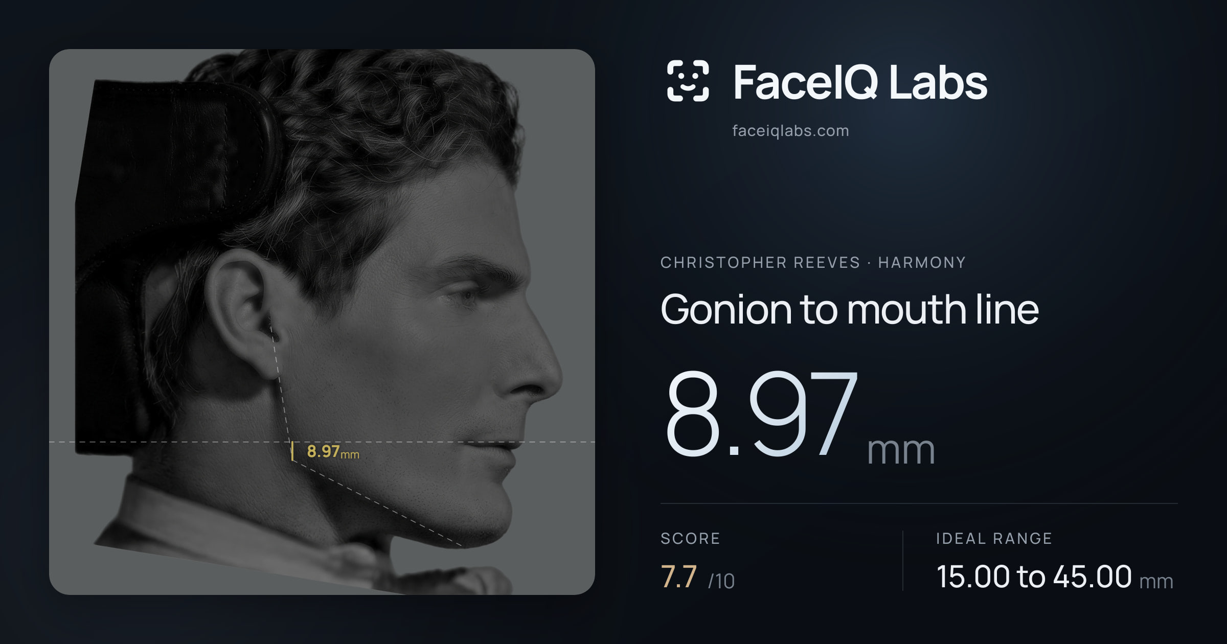 Christopher Reeves Gonion to mouth line: 8.97mm, drawn on the photo