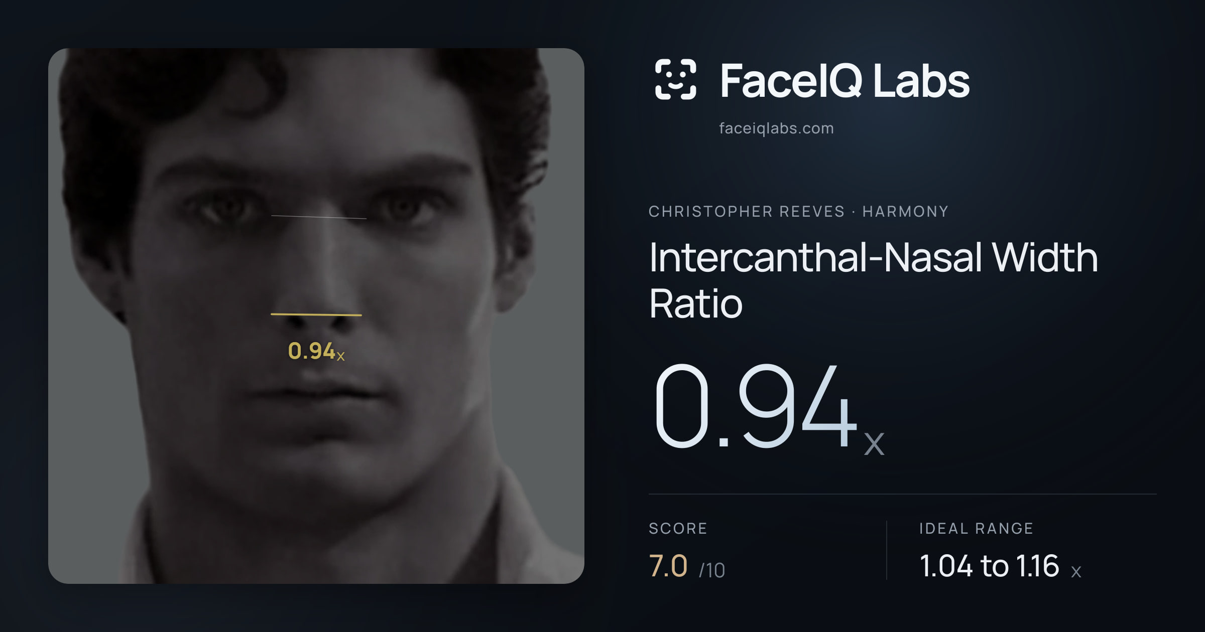 Christopher Reeves Intercanthal-Nasal Width Ratio: 0.94x, drawn on the photo