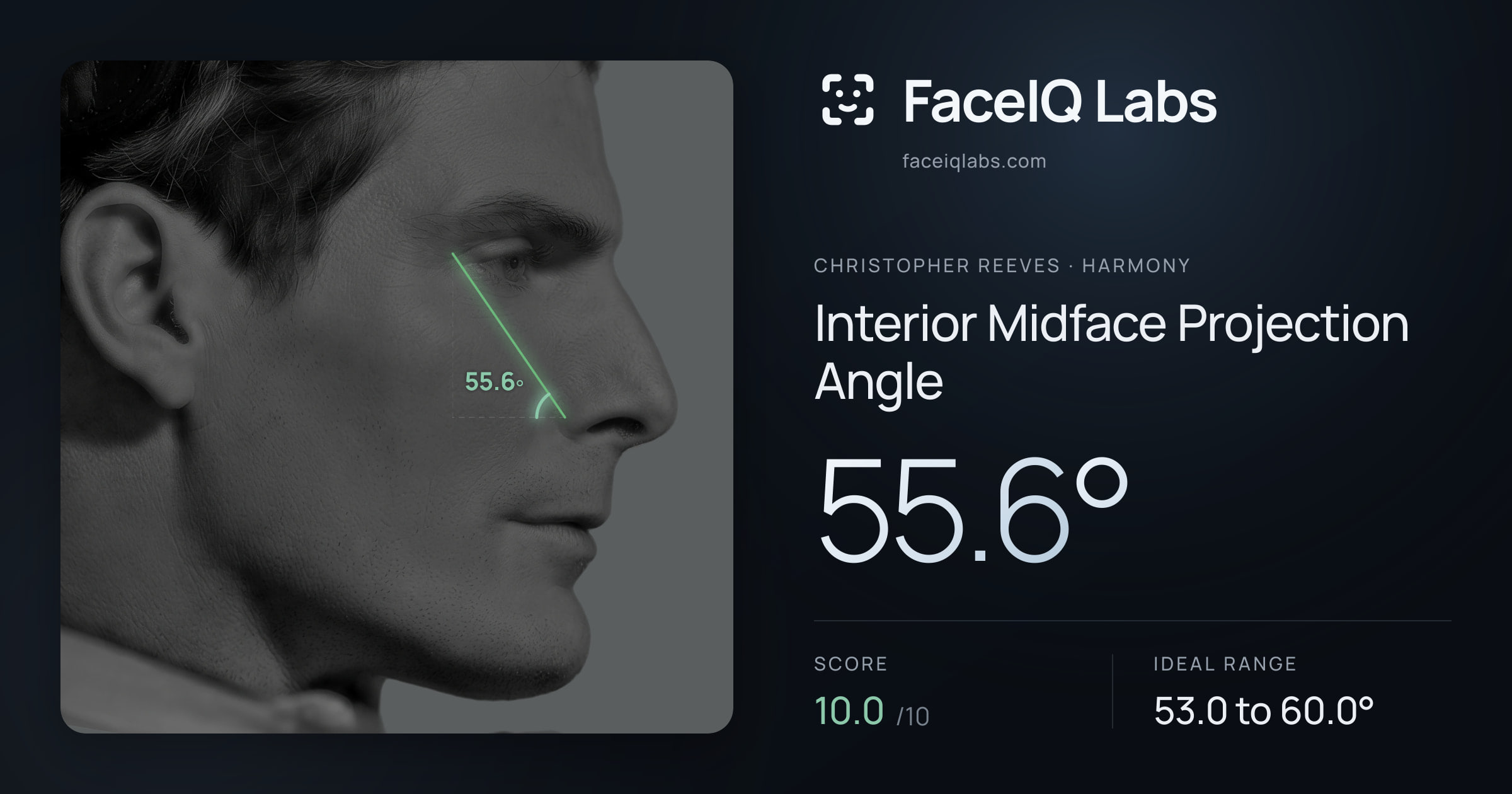 Christopher Reeves Interior Midface Projection Angle: 55.6°, drawn on the photo