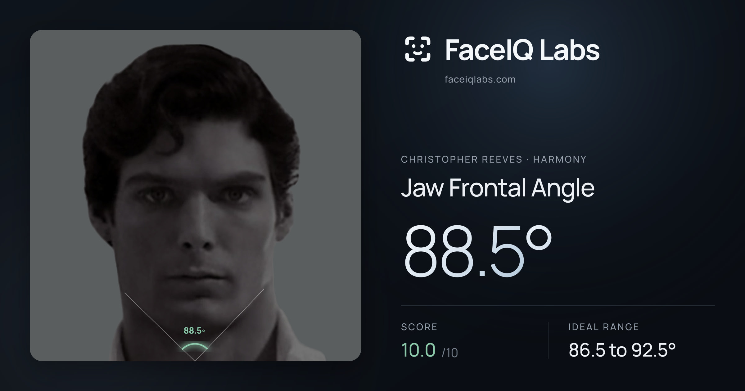 Christopher Reeves Jaw Frontal Angle: 88.5°, drawn on the photo