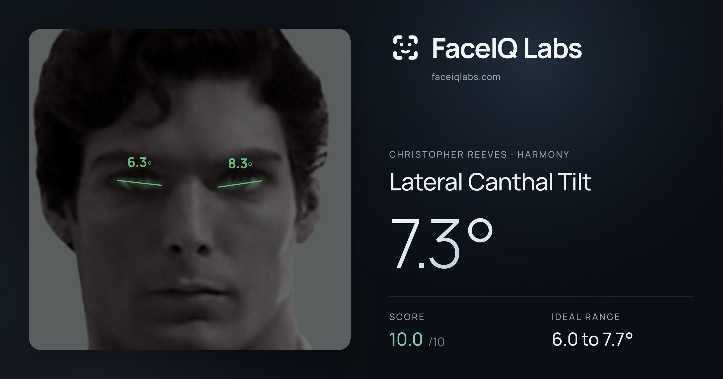 Christopher Reeves Lateral Canthal Tilt: 7.3°, drawn on the photo