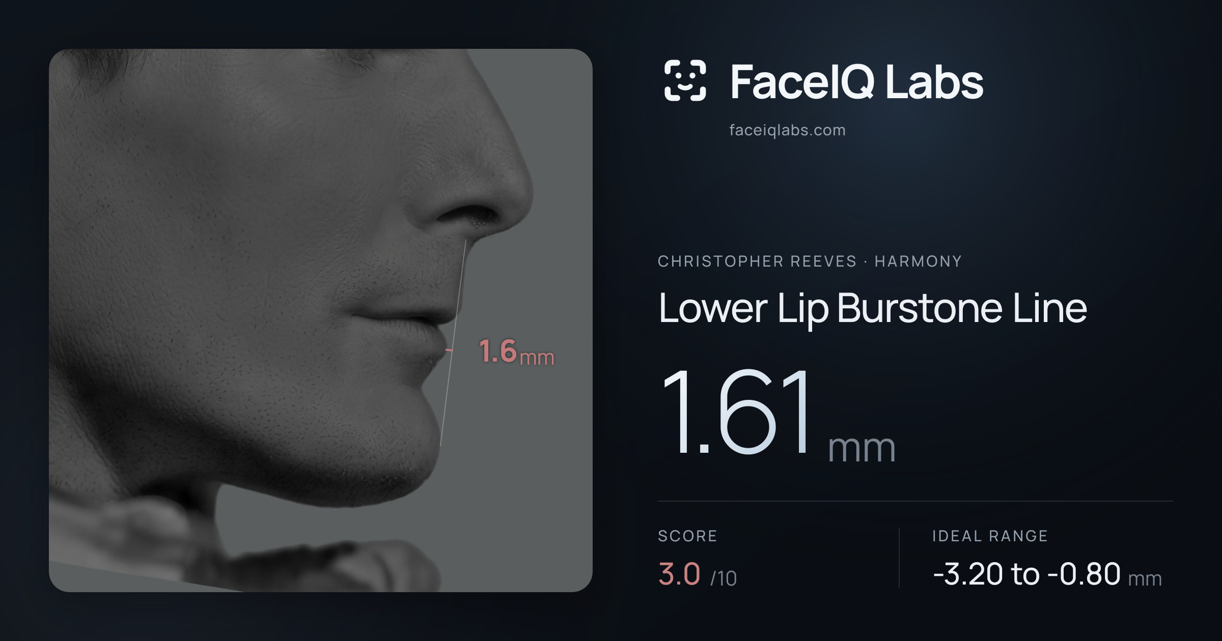 Christopher Reeves Lower Lip Burstone Line: 1.61mm, drawn on the photo