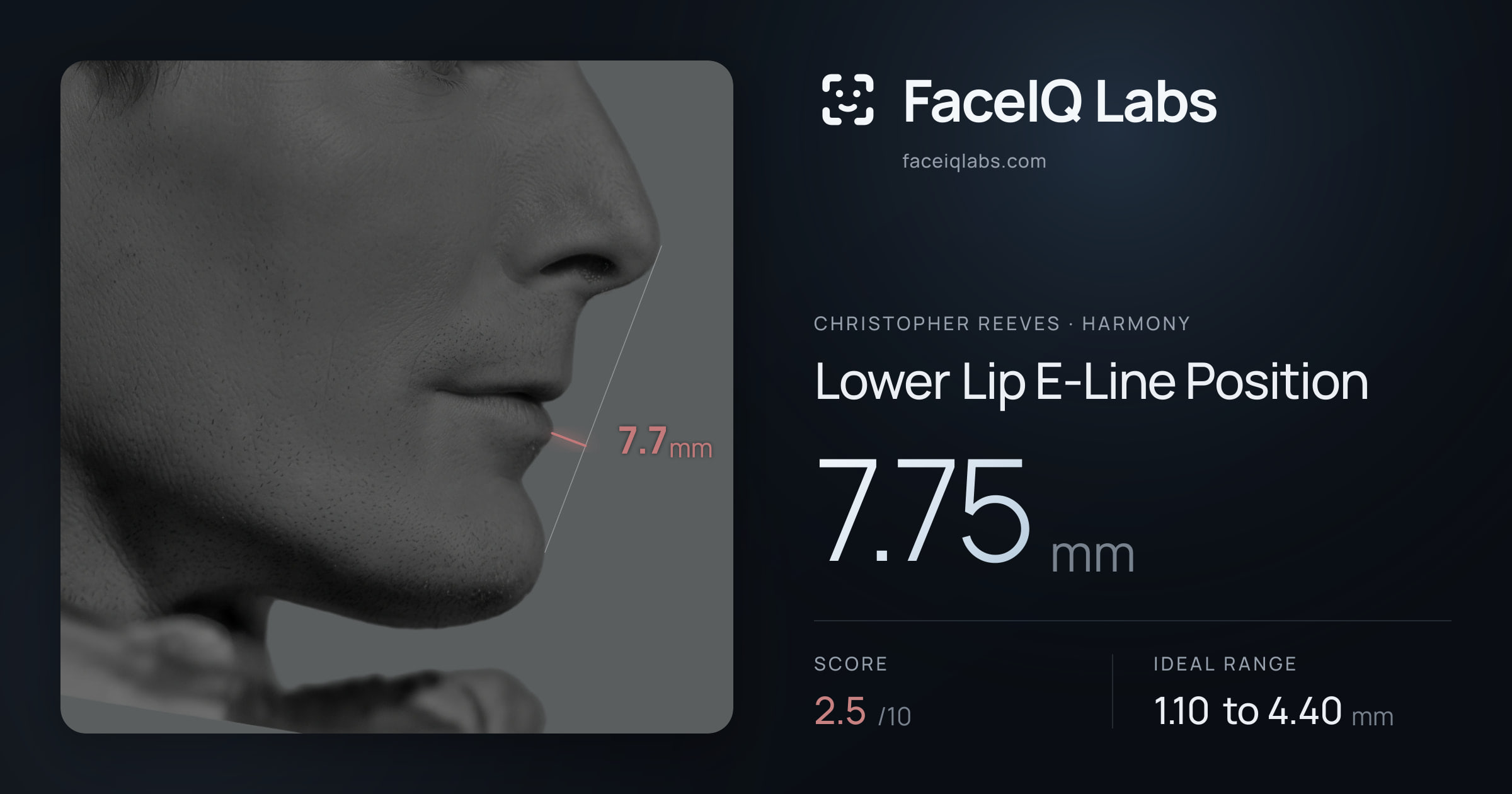 Christopher Reeves Lower Lip E-Line Position: 7.75mm, drawn on the photo