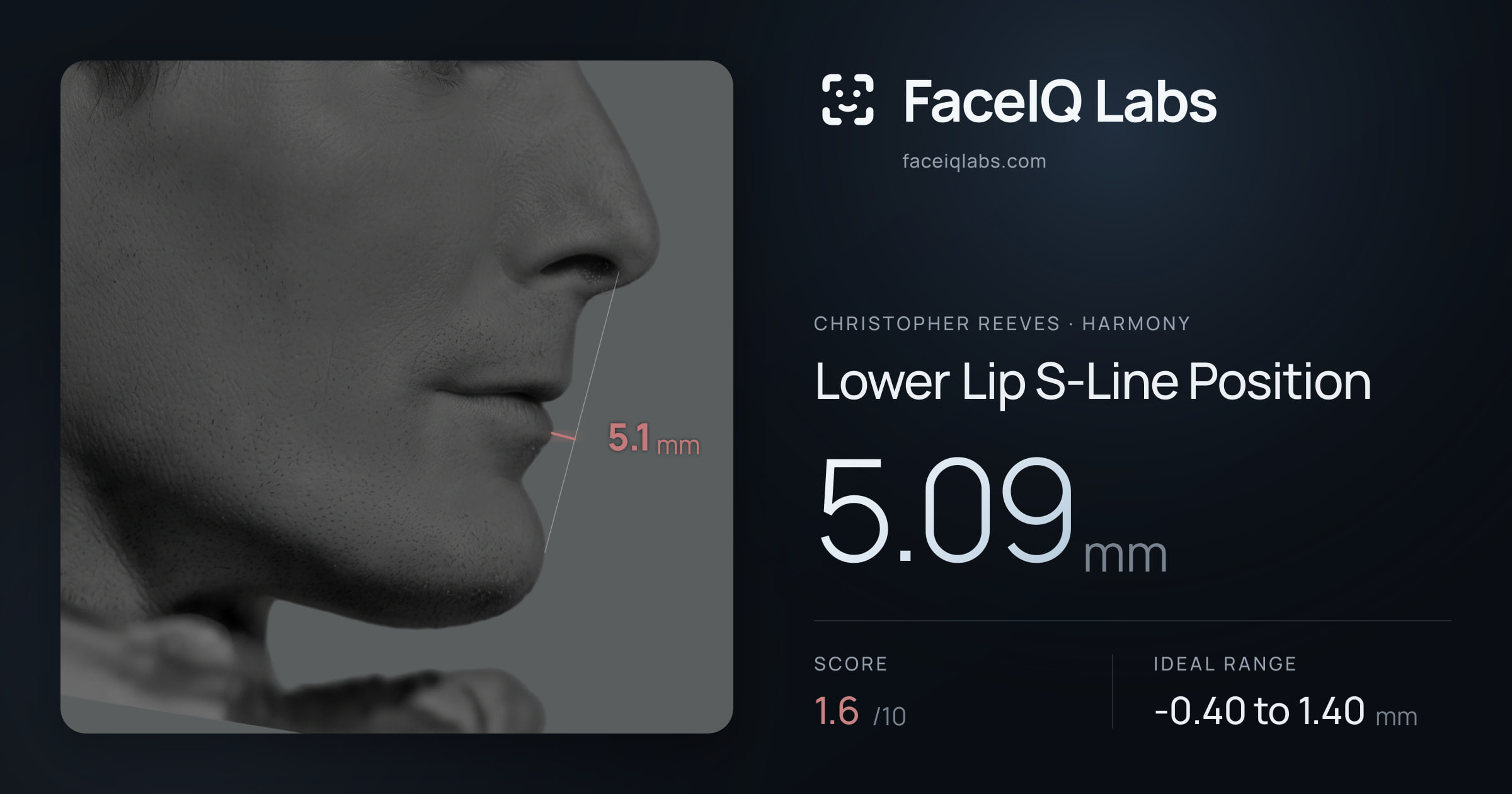 Christopher Reeves Lower Lip S-Line Position: 5.09mm, drawn on the photo