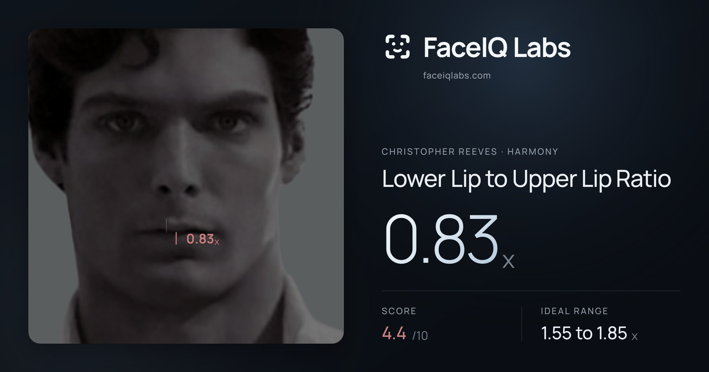 Christopher Reeves Lower Lip to Upper Lip Ratio: 0.83x, drawn on the photo