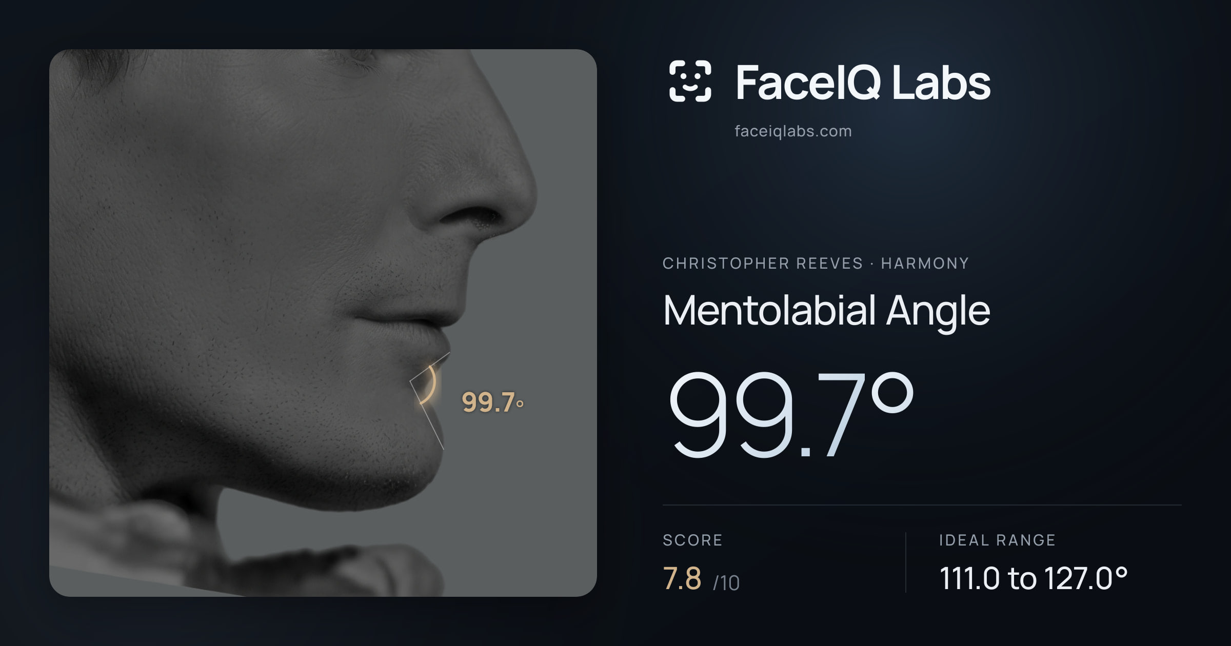 Christopher Reeves Mentolabial Angle: 99.7°, drawn on the photo