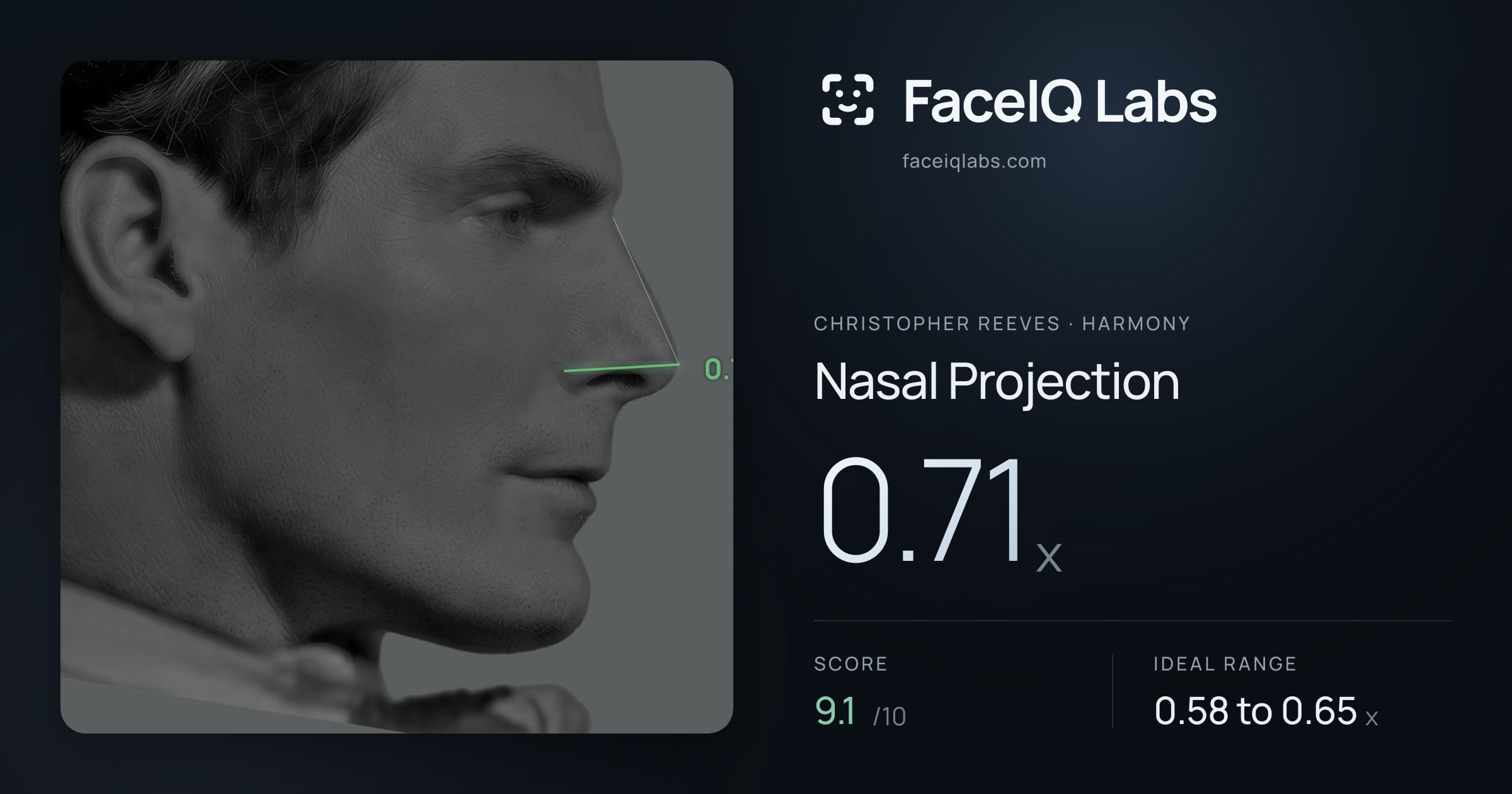 Christopher Reeves Nasal Projection: 0.71x, drawn on the photo