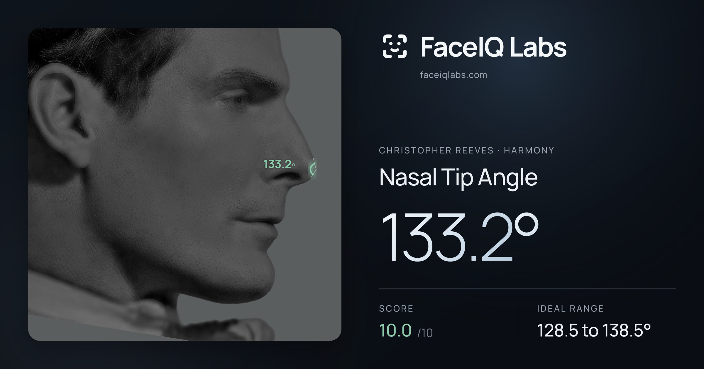 Christopher Reeves Nasal Tip Angle: 133.2°, drawn on the photo