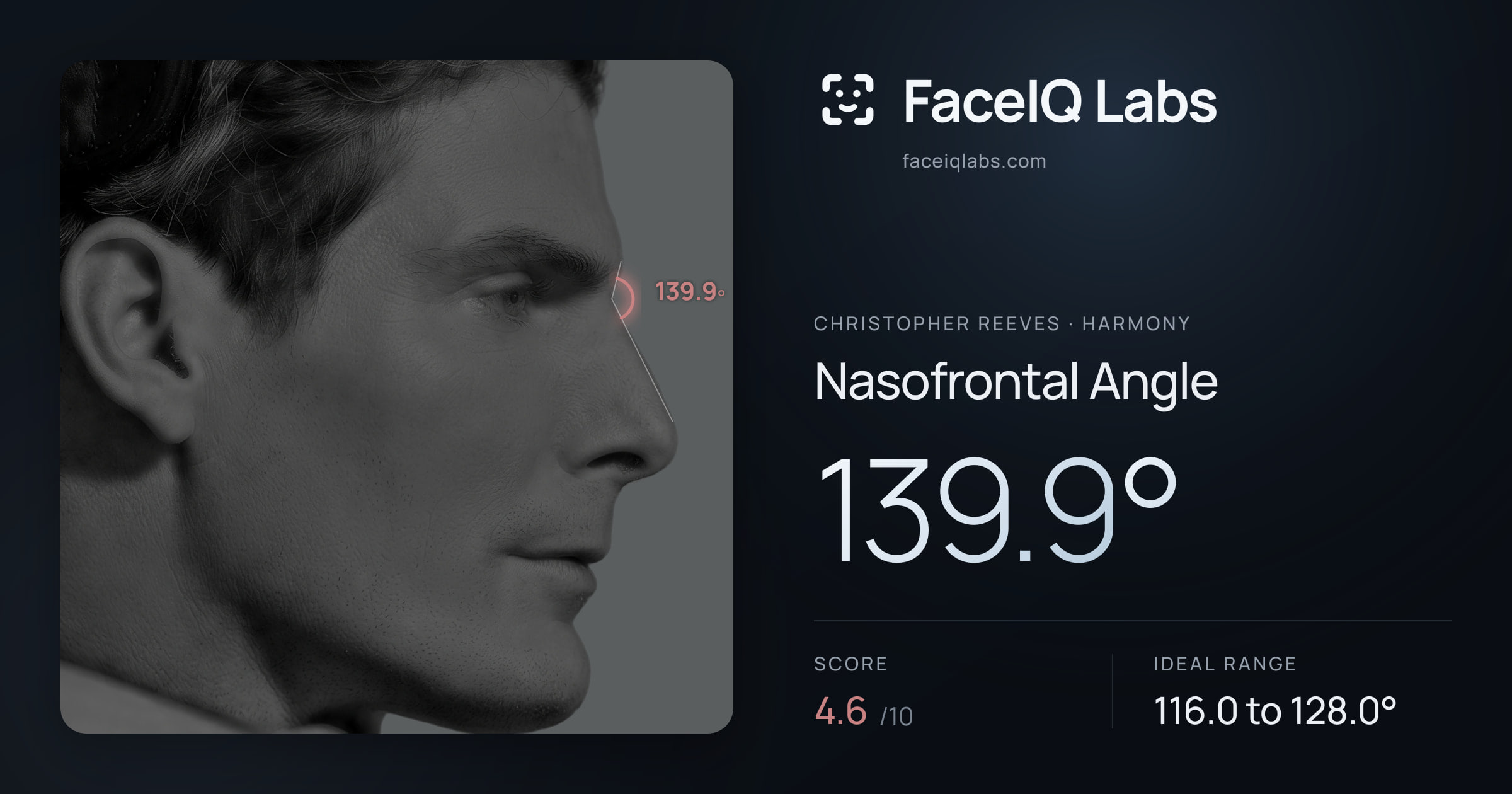 Christopher Reeves Nasofrontal Angle: 139.9°, drawn on the photo