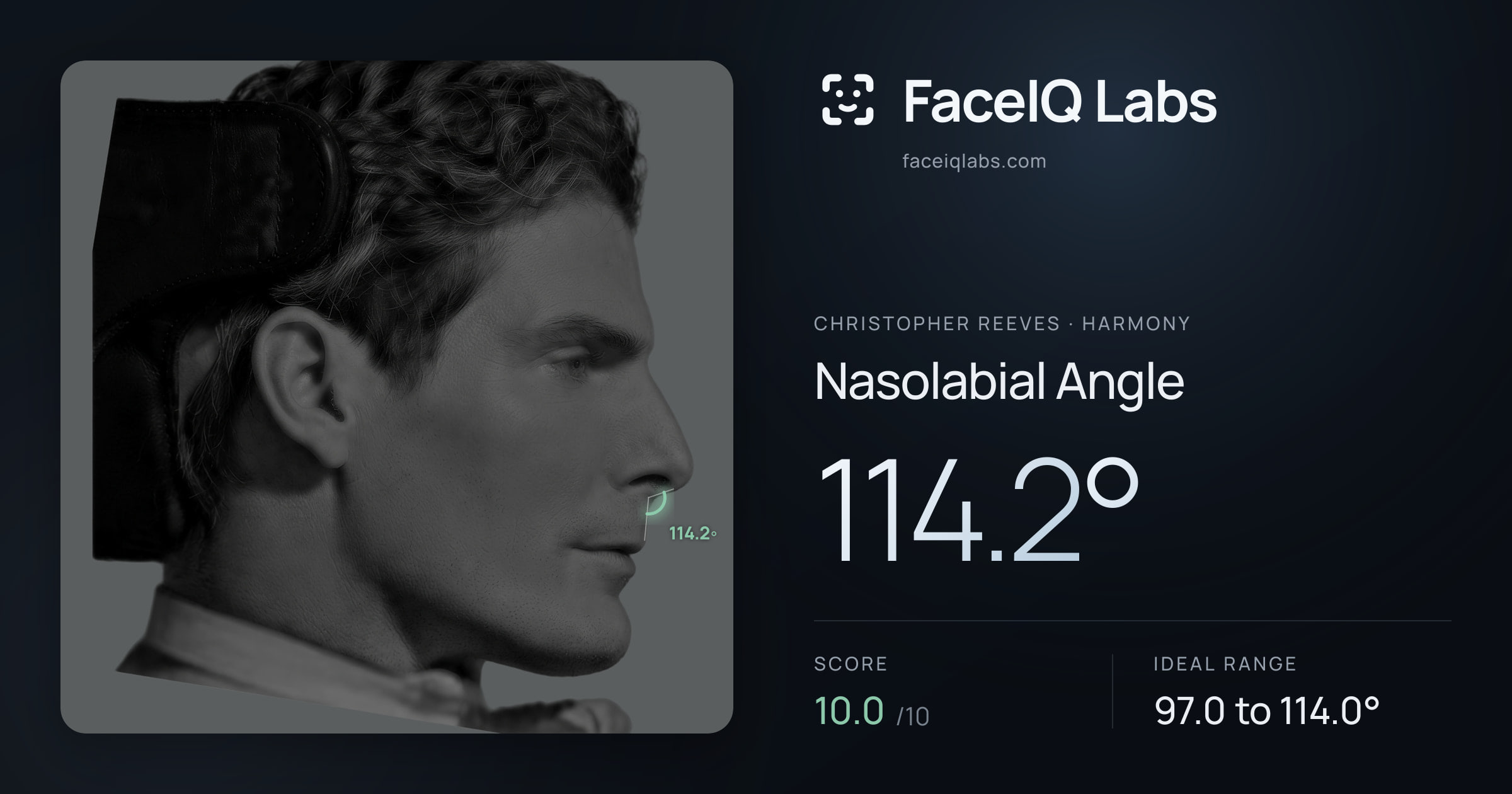 Christopher Reeves Nasolabial Angle: 114.2°, drawn on the photo