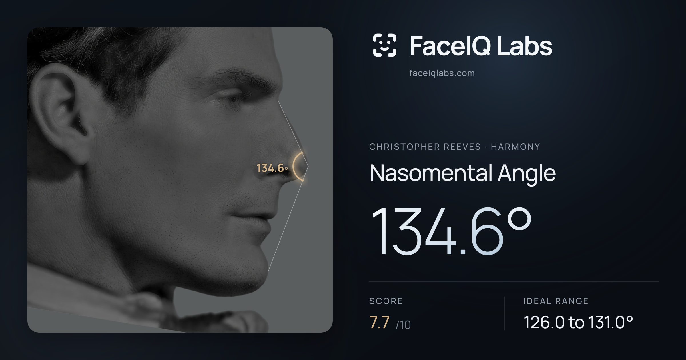 Christopher Reeves Nasomental Angle: 134.6°, drawn on the photo