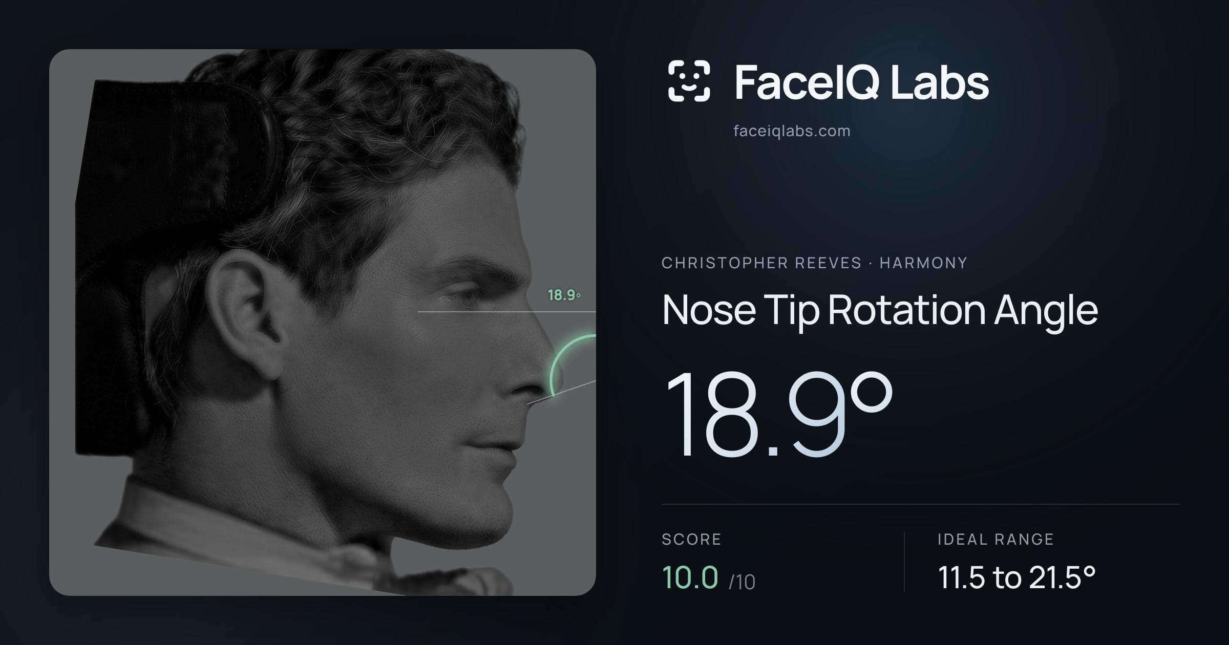 Christopher Reeves Nose Tip Rotation Angle: 18.9°, drawn on the photo