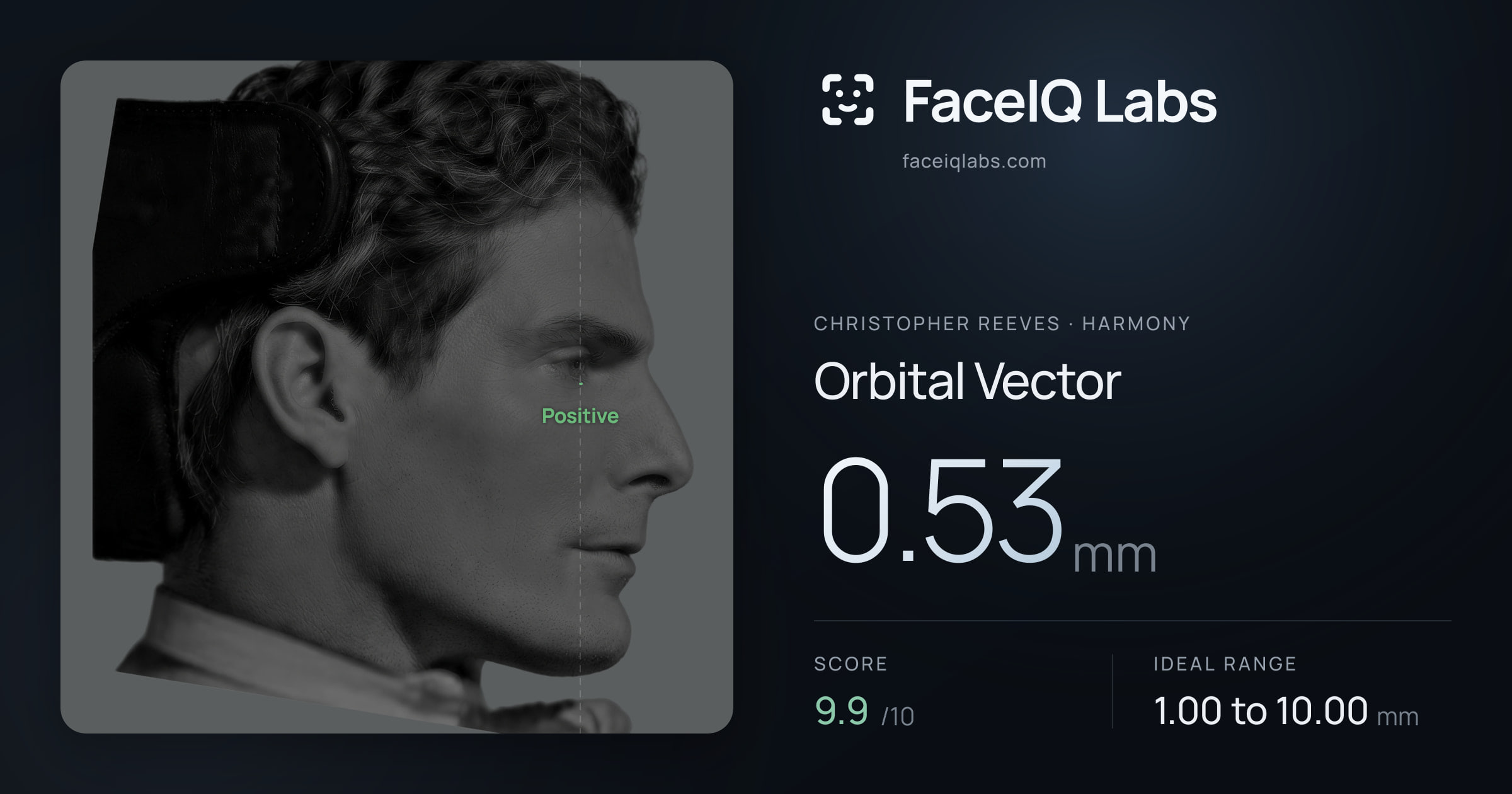 Christopher Reeves Orbital Vector: 0.53mm, drawn on the photo