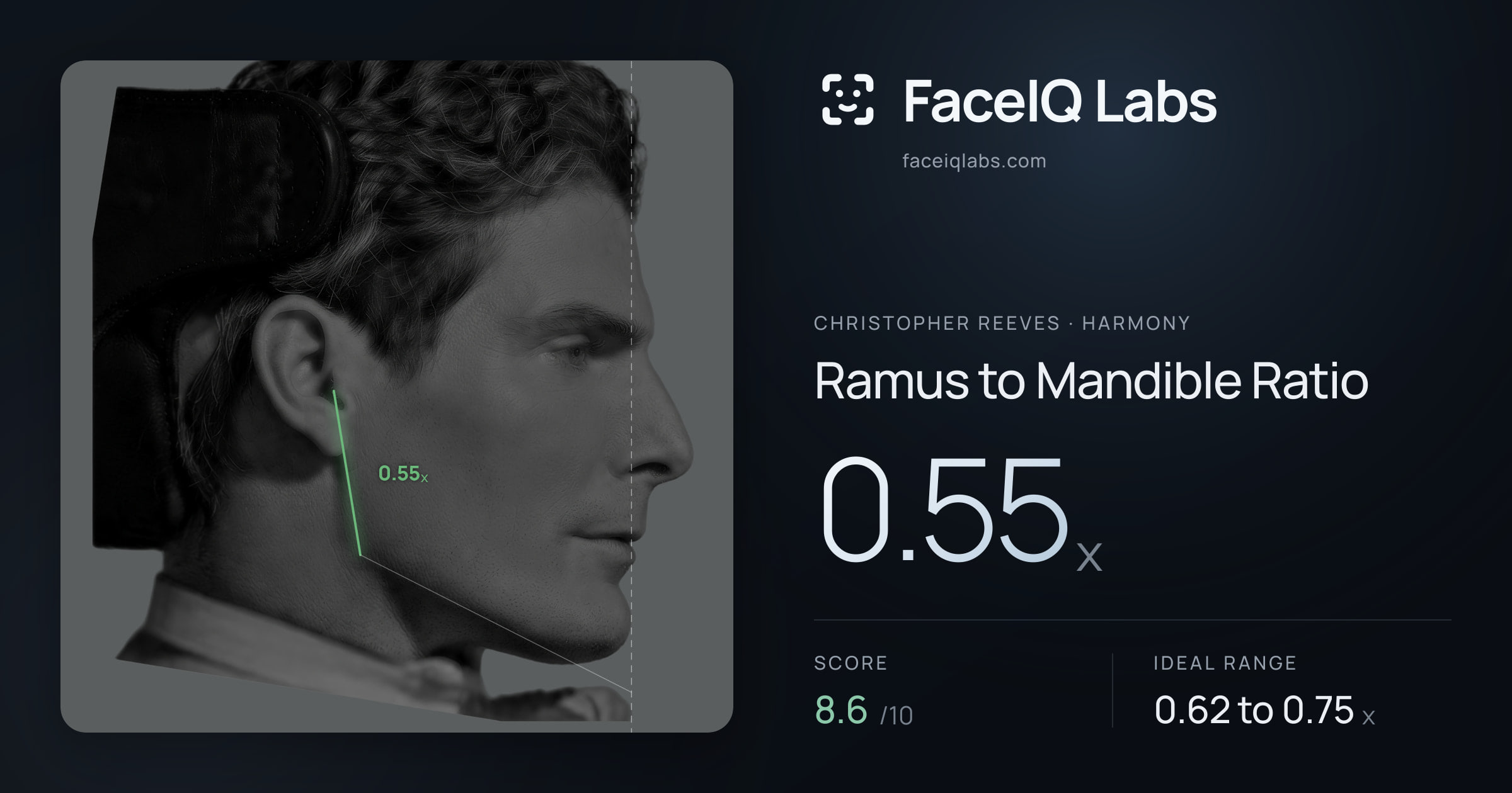 Christopher Reeves Ramus to Mandible Ratio: 0.55x, drawn on the photo