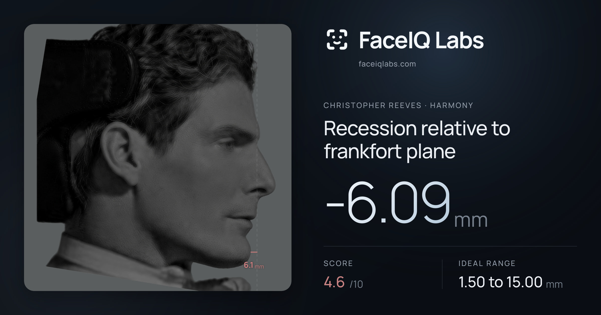 Christopher Reeves Recession relative to frankfort plane: -6.09mm, drawn on the photo