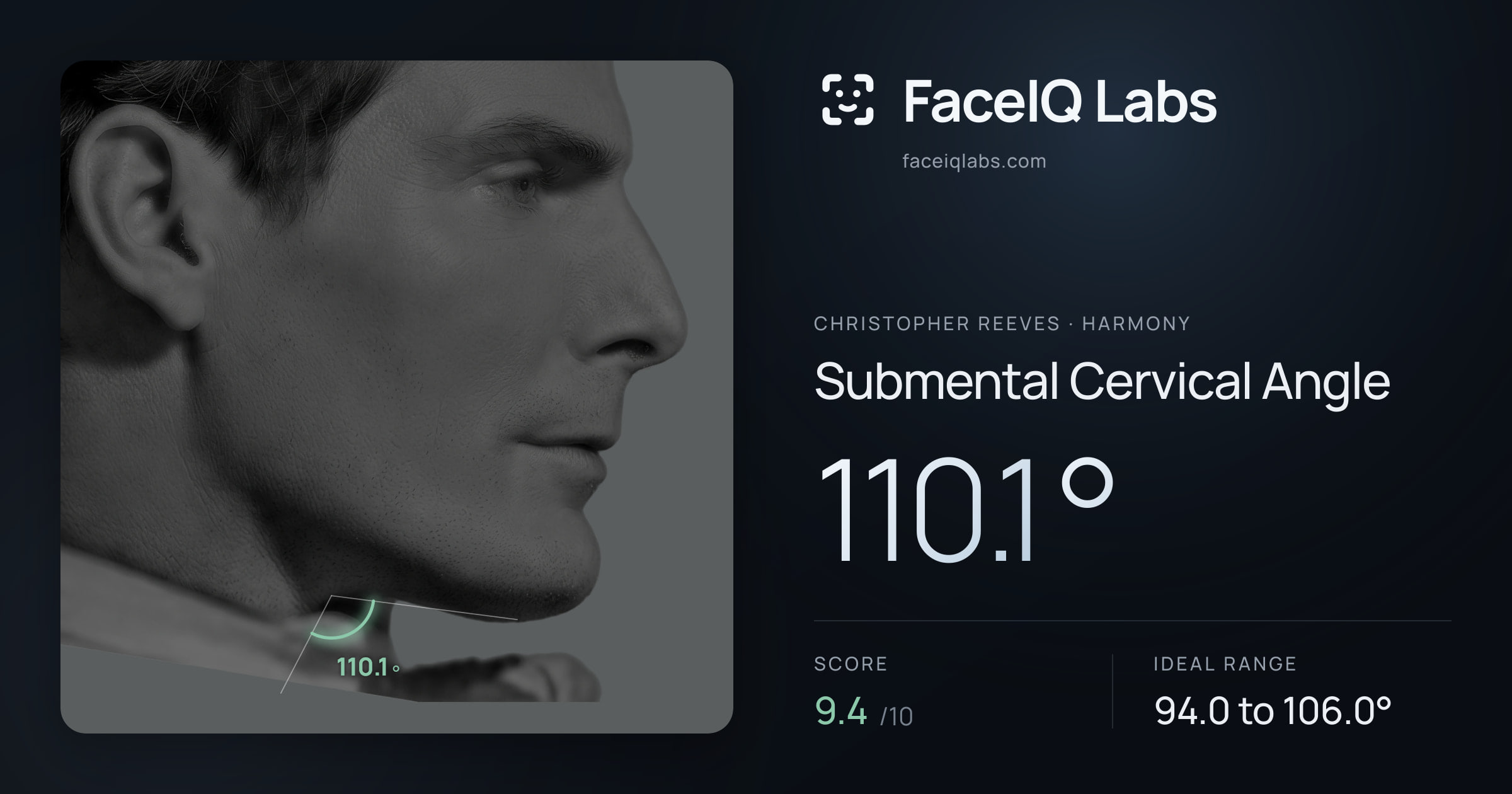 Christopher Reeves Submental Cervical Angle: 110.1°, drawn on the photo